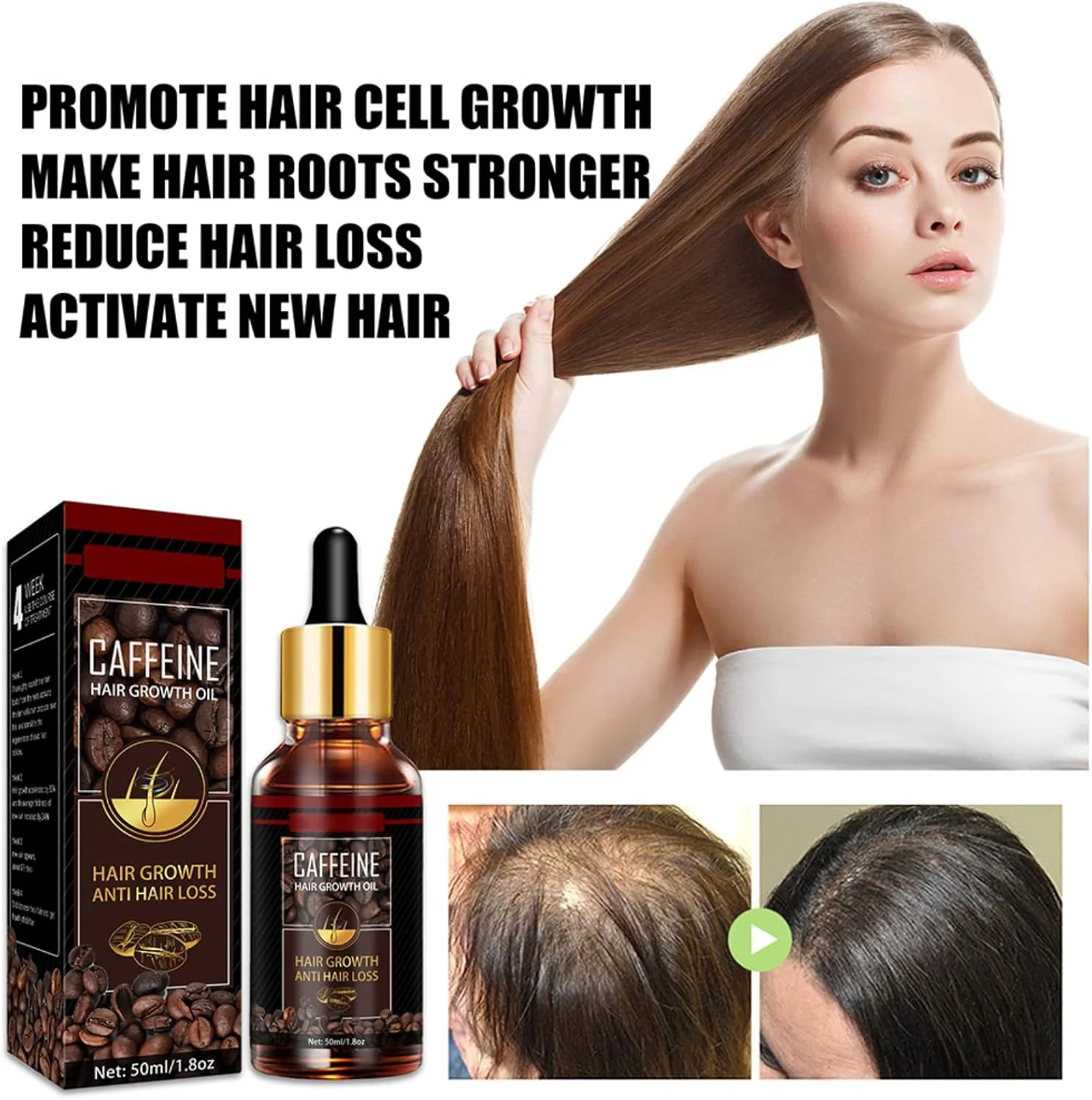 سرم رشد مجدد مو NLLNT، سرم ضد ریزش مو، درمان ریزش و تقویت موهای نازک، افزایش ضخامت و تقویت رشد مو