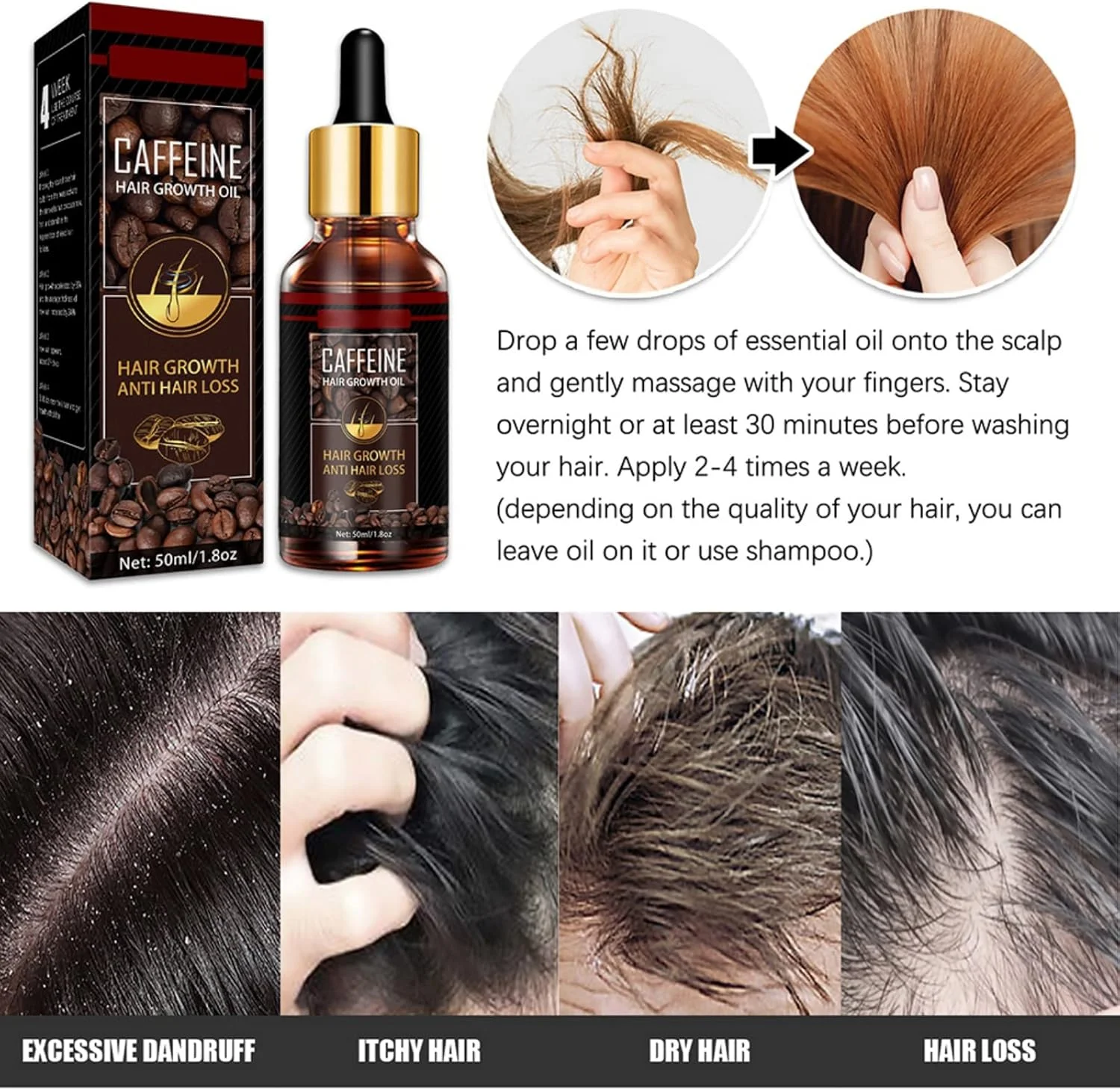 سرم رشد مجدد مو NLLNT، سرم ضد ریزش مو، درمان ریزش و تقویت موهای نازک، افزایش ضخامت و تقویت رشد مو