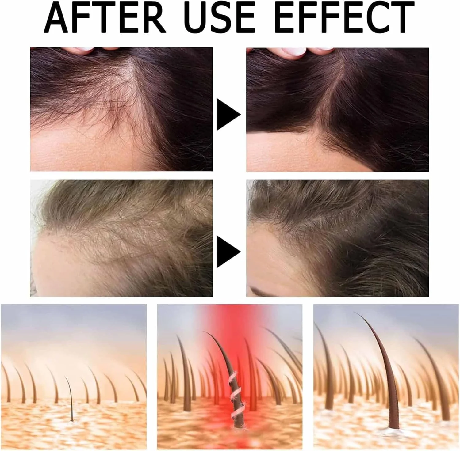 آمپول های تقویت کننده و رشد مجدد مو Liascy FINAS، سرم رشد مو، سرم رشد مو بیوتین، درمان ضد ریزش مو Liascy، تقویت کننده و رشد مجدد مو برای موهای نازک (3 عدد)