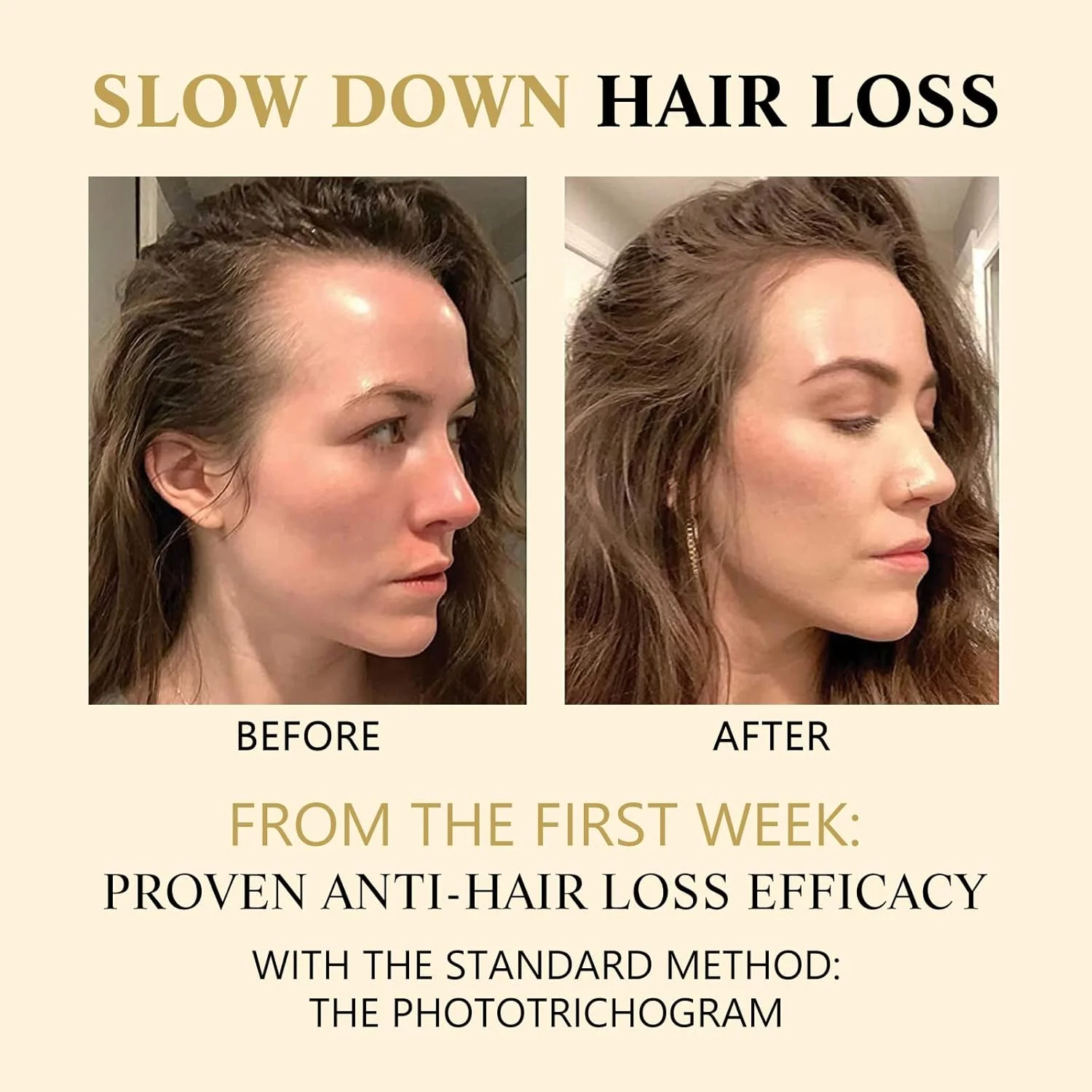 سرم رشد مو برای زنان، احیای مو برای مردان و زنان، سرم ماساژ رولی بیوتین برای رشد مو که به طور محسوسی موها را ضخیم می کند، ریزش مو را متوقف می کند و پوشش پوست سر را افزایش می دهد (2 عدد)