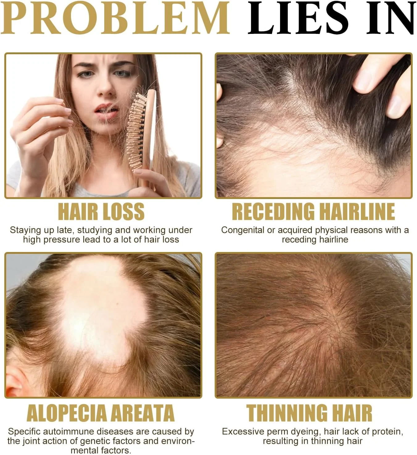 سرم رشد مو برای زنان، احیای مو برای مردان و زنان، سرم ماساژ رولی بیوتین برای رشد مو که به طور محسوسی موها را ضخیم می کند، ریزش مو را متوقف می کند و پوشش پوست سر را افزایش می دهد (2 عدد)