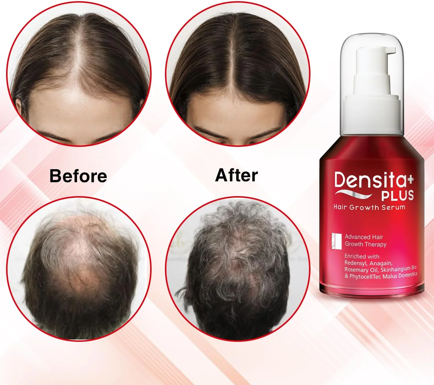 سرم تقویت کننده و رشد مو Regaliz Densita Plus | حاوی Redensyl، Anagain و روغن رزماری | کمک به کاهش ریزش مو، تقویت مو و حمایت از رشد سالم | 60 میلی لیتر