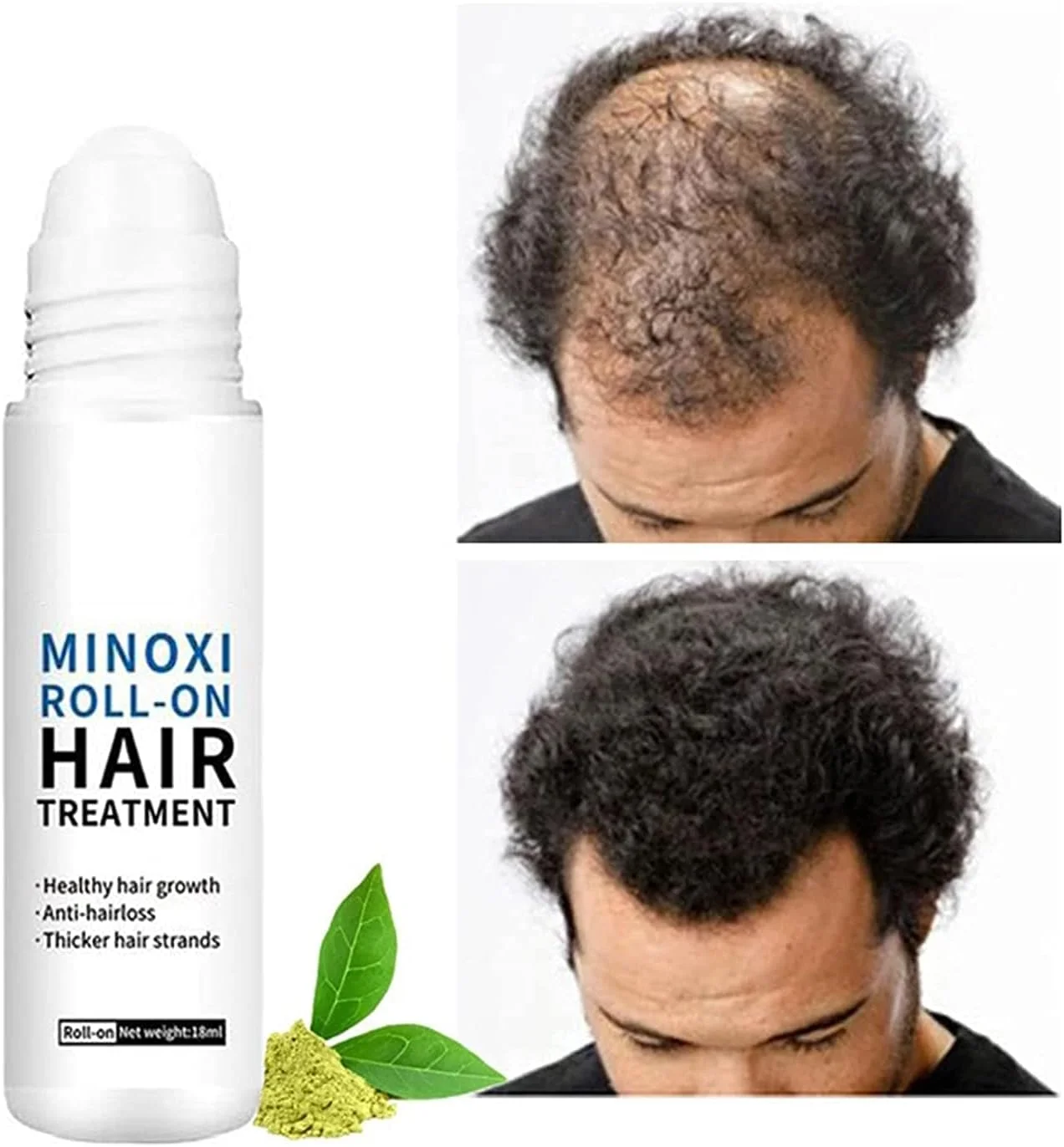 درمان مو با رول-آن Minoxi Re:act، سرم رشد مو برای موهای خشک و آسیب دیده و رشد، سرم ضد وز برای موهای خشک، موهای فر و موهای آسیب دیده (1 عدد)