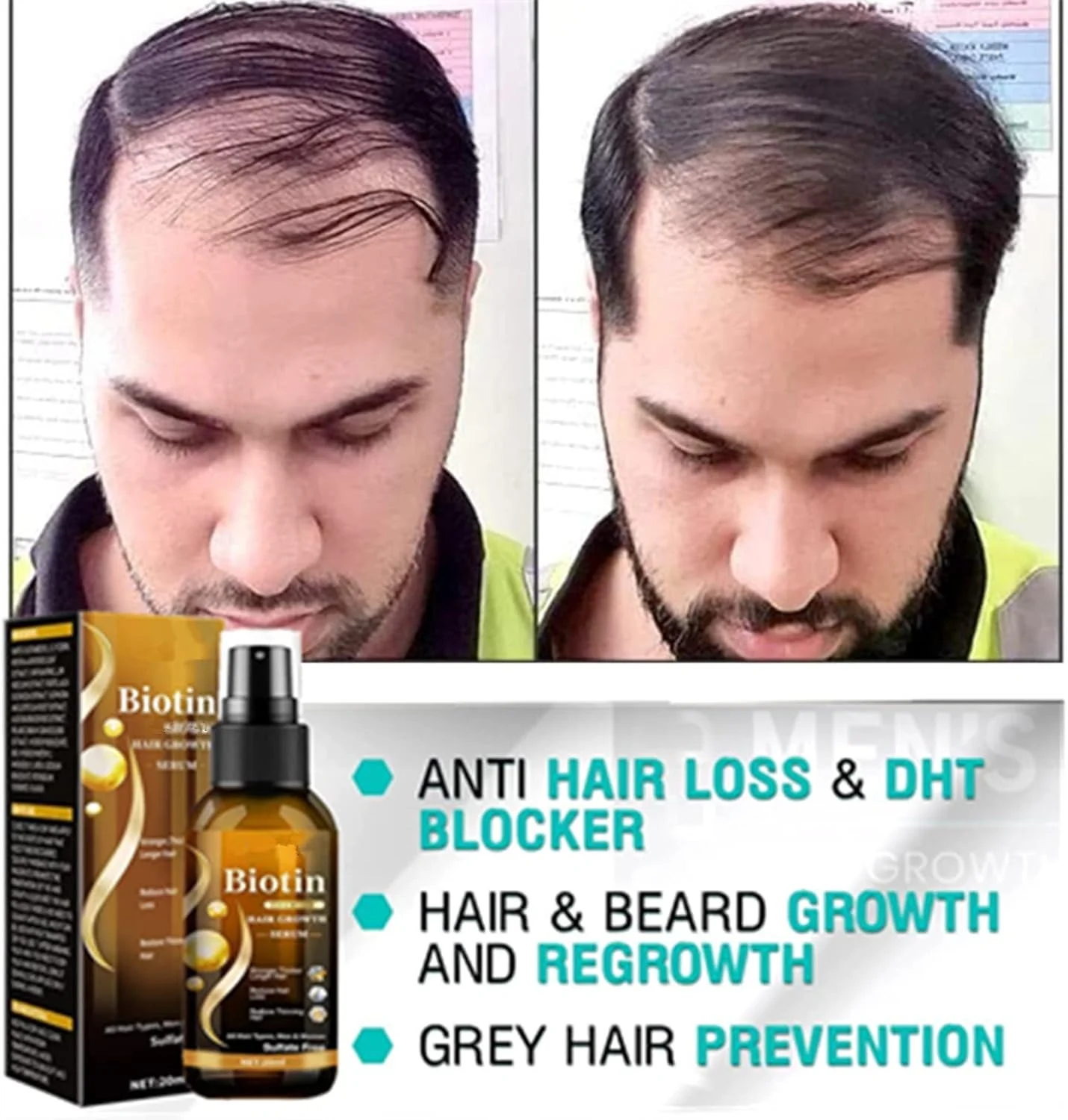 اسپری سرم مو و ریش Re'awaken، سرم رشد مو و ریش Re'awaken، اسپری سرم مو Re'awaken، برای فعال کردن موهای خفته و مرطوب کننده پوست سر (3 عدد)