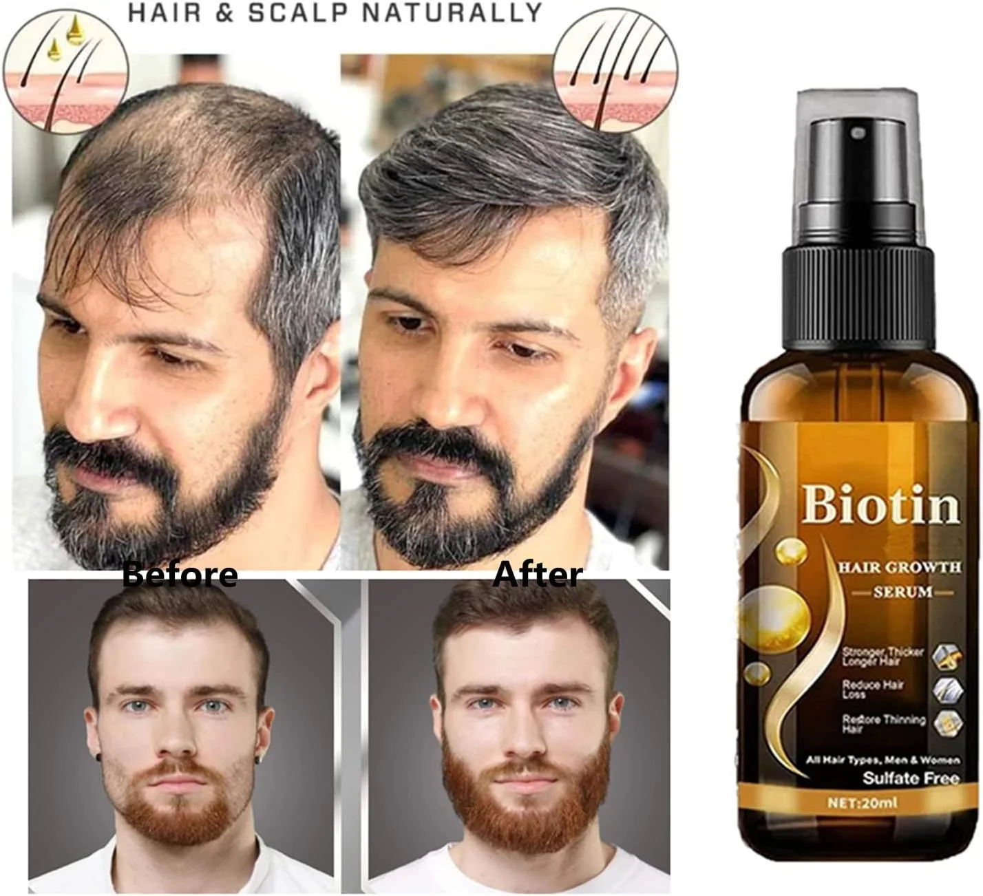 اسپری سرم مو و ریش Re'awaken، سرم رشد مو و ریش Re'awaken، اسپری سرم مو Re'awaken، برای فعال کردن مو و فولیکول های خفته و مرطوب کننده پوست سر (1 عدد)