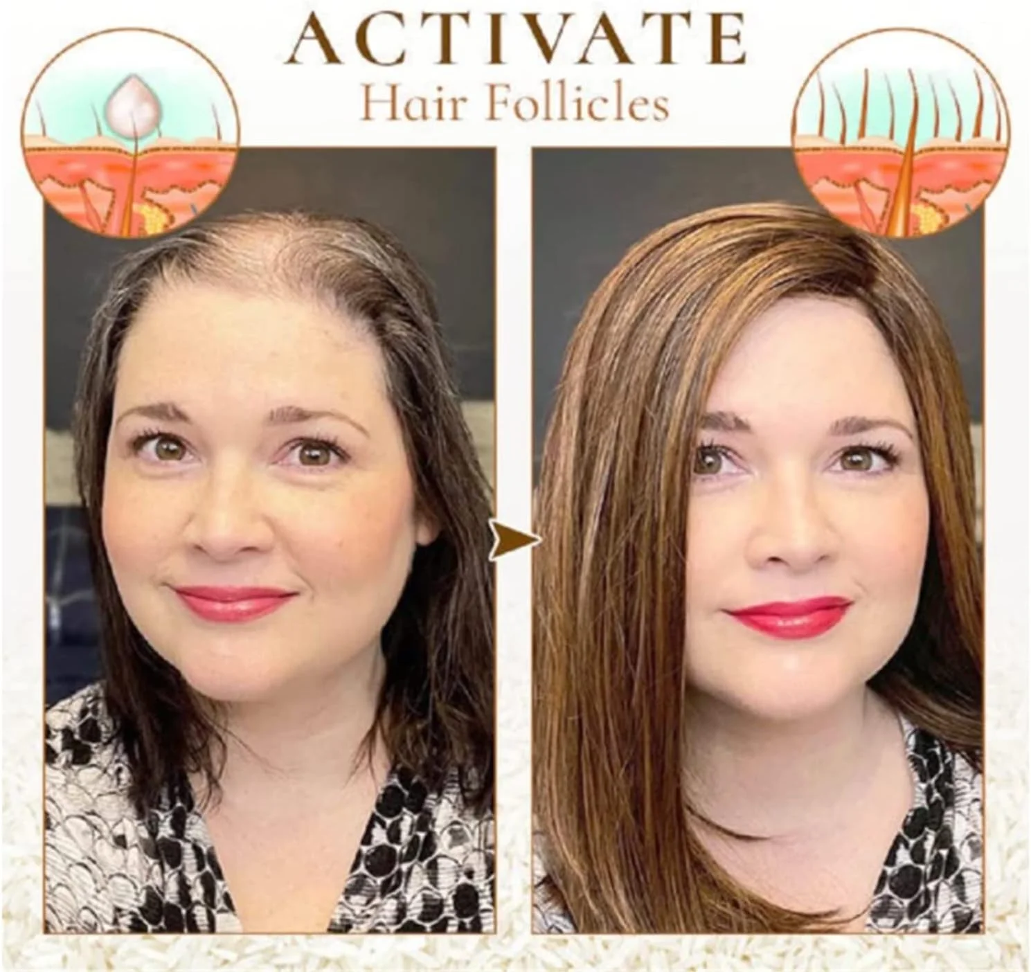 سرم آب برنج تخمیر شده PurAect، آب برنج برای رشد مو، سرم رشد مو بیوتین، سرم رشد مو آب برنج برای نازک شدن مو و ریزش مو (3 عدد)