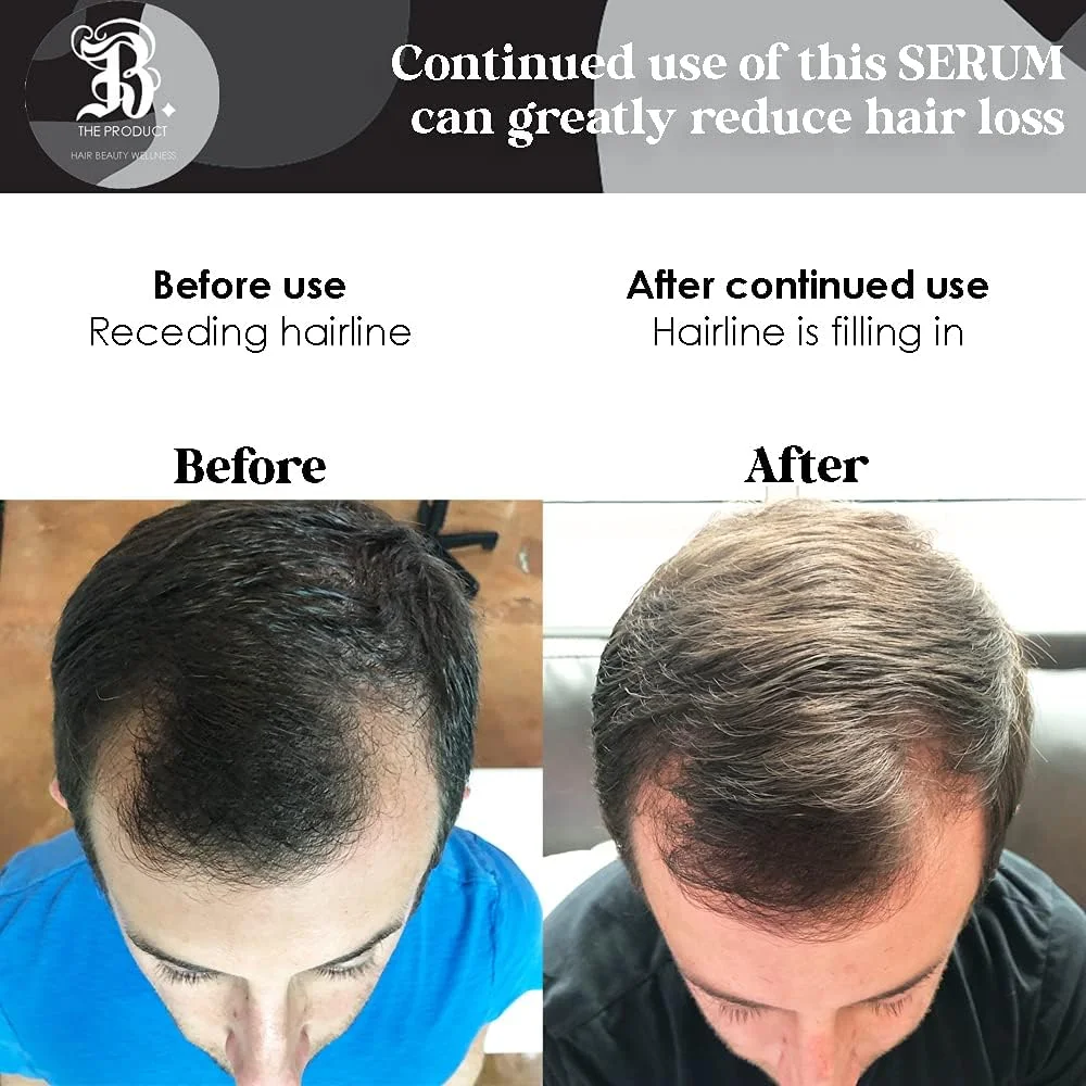 محصول B درمان نرم کننده و تقویت کننده مو با ویتامین بیوتین - بیوتین محافظ حرارتی قوی، سرم حالت دهنده ضد ریزش مو برای موهای خشک و آسیب دیده - محافظ اشعه ماوراء بنفش - 118 میلی لیتر