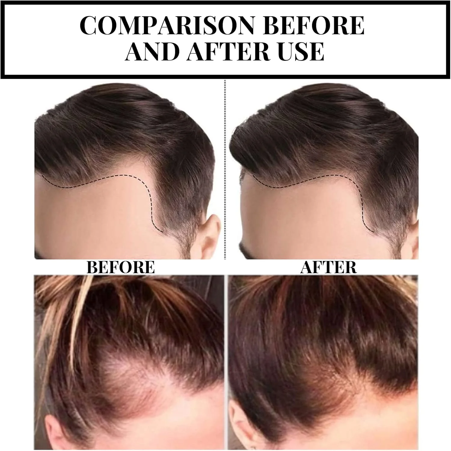 روغن رشد مو عصاره گیاهی سونا، روغن رشد مو عصاره گیاهی، سرم رشد مو بیوتین، رشد سریع مو (1 عدد) 1 عدد 1 عدد روغن رشد مو عصاره گیاهی سونا، روغن رشد مو عصاره گیاهی، سرم رشد مو بیوتین، رشد سریع مو (1 عدد) 1 عدد 1 عدد