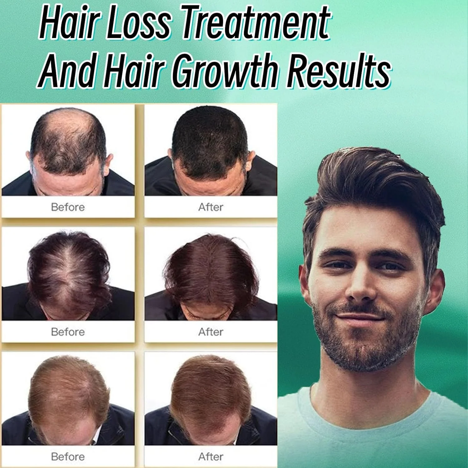 سرم رشد مو برای جلوگیری از ریزش مو، روغن رشد مو با فرمولاسیون طبیعی و خالص، سرم مو برای مردان و زنان، روغن زنجبیل برای جلوگیری از ریزش بیشتر و تقویت مو