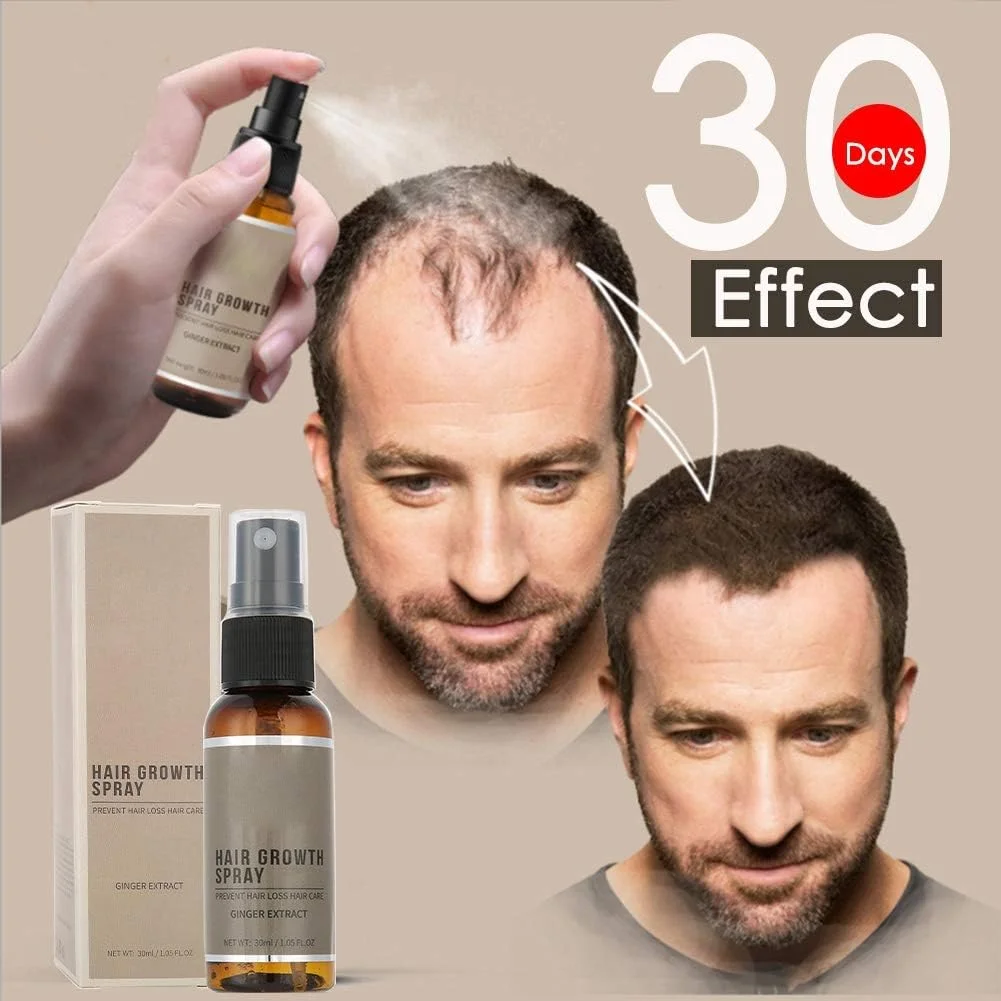 سرم رشد مو، اسپری رشد مو، اسانس طبیعی سریع رشد مو جینسینگ، درمان ریزش مو مایع اسپری برای درمان ریزش مو مردان و زنان 30 میلی لیتر سرم رشد مو، اسپری رشد مو، اسانس طبیعی سریع رشد مو جینسینگ، درمان ریزش مو مایع اسپری برای درمان ریزش مو مردان و زنان 30 میلی لیتر