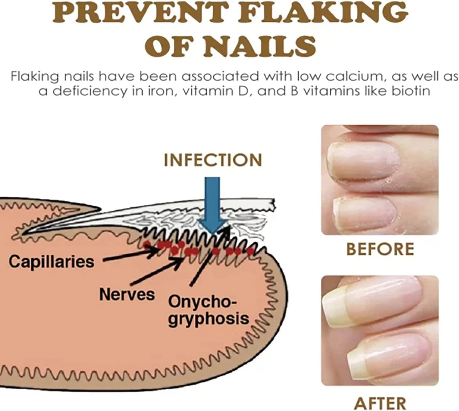 سرم ارگانیک ترمیم کننده و تقویت کننده ناخن، سرم رشد ناخن، سرم رشد ناخن Reconstrux، سرم تقویت کننده و رشد سریع ناخن Nailgro Intense 7 روزه، مناسب برای ناخن های آسیب دیده و تغییر رنگ یافته (3 عدد)