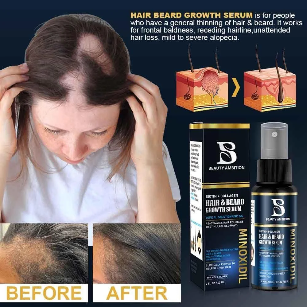 سرم رشد مو و ریش ماینوکسیدیل با بیوتین + کلاژن 60 میلی لیتر