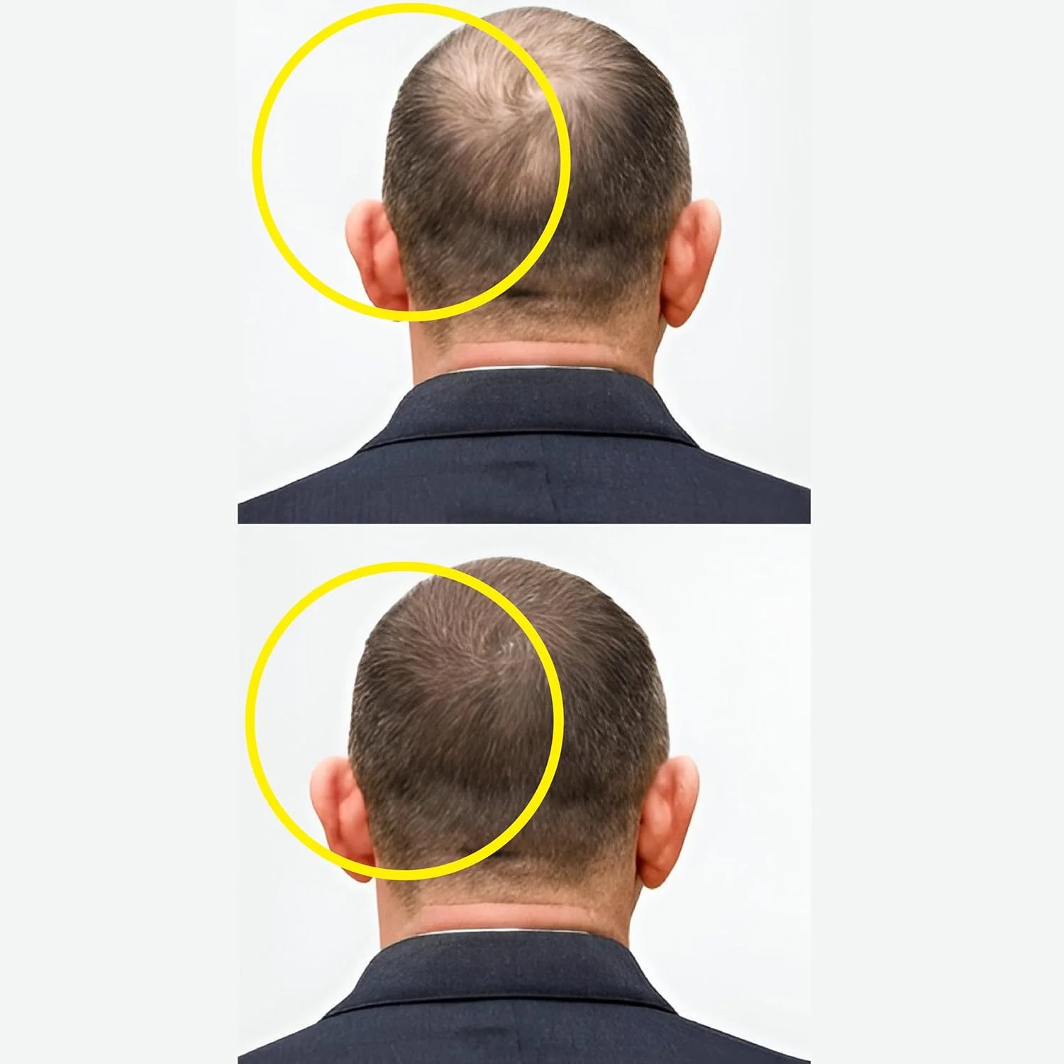 سرم رشد مو Masofta برای تقویت رشد مو و کنترل ریزش مو با 3% Redensyl، 5% Capixyl، 4% Anagain، 3% Procapil و 3% Baicapil، رزماری و بیوتین، برای آقایان و بانوان، 30 میلی لیتر
