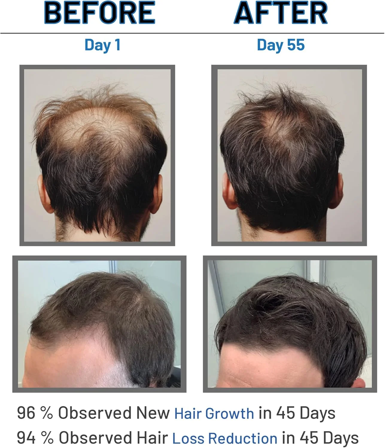 سرم رشد مو لوموسیک به کنترل ریزش مو و رشد مو کمک می کند - 30 میلی لیتر سرم رشد مو لوموسیک به کنترل ریزش مو و رشد مو کمک می کند - 30 میلی لیتر