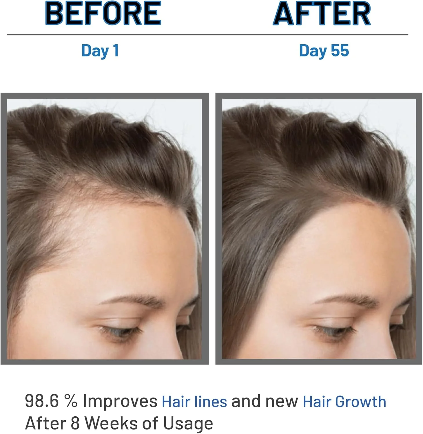 سرم رشد مو لوموسیک به کنترل ریزش مو و رشد مو کمک می کند - 30 میلی لیتر سرم رشد مو لوموسیک به کنترل ریزش مو و رشد مو کمک می کند - 30 میلی لیتر