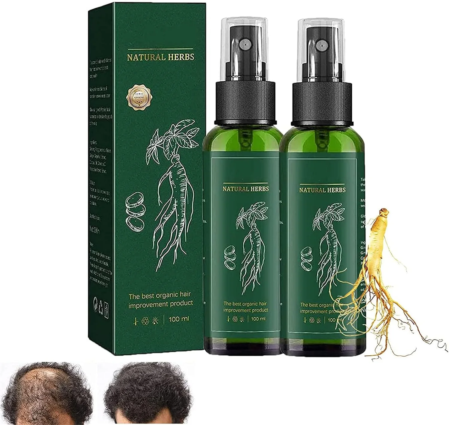 اسپری احیا کننده مو جینسینگ قرمز KORTIN - اسپری سرم رشد مو جینسینگ هیونگانگ کره، سرم اسپری رشد مو زنجبیل، تغذیه کننده پوست سر ضد ریزش مو برای زنان و مردان (2 عدد) اسپری احیا کننده مو جینسینگ قرمز KORTIN - اسپری سرم رشد مو جینسینگ هیونگانگ کره، سرم اسپری رشد مو زنجبیل، تغذیه کننده پوست سر ضد ریزش مو برای زنان و مردان (2 عدد)