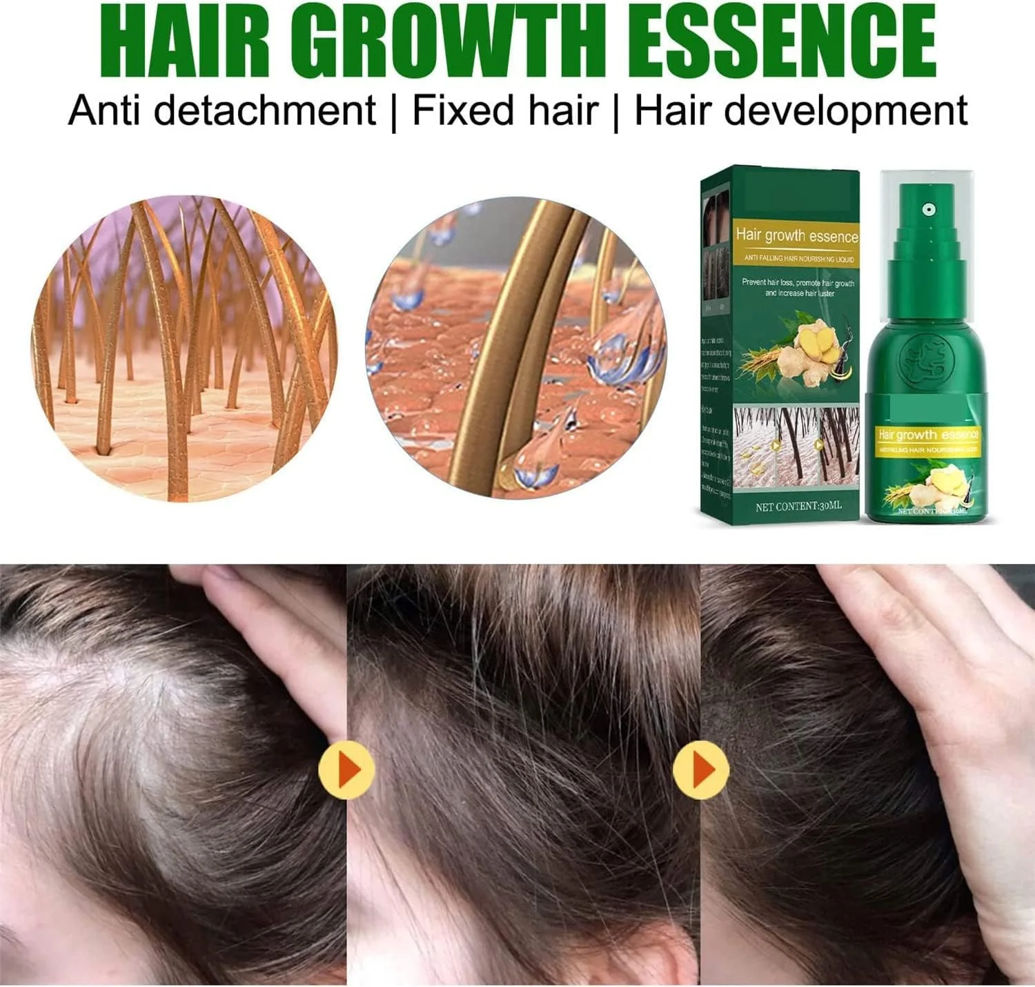 اسپری سرم رشد مجدد مو جینسینگ کره ای، تحریک 10 برابری رشد مو برای آقایان و بانوان، 30 میلی لیتر (3 عدد)