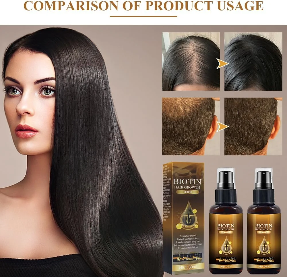 سرم رشد مو KUIRUNRX®، دو عدد سرم رشد مو بیوتین، سرم لوکس رشد مو بیوتین برای زنان و مردان برای تسریع رشد مو و مقابله با ریزش مو (30 میلی لیتر) سرم رشد مو KUIRUNRX®، دو عدد سرم رشد مو بیوتین، سرم لوکس رشد مو بیوتین برای زنان و مردان برای تسریع رشد مو و مقابله با ریزش مو (30 میلی لیتر)