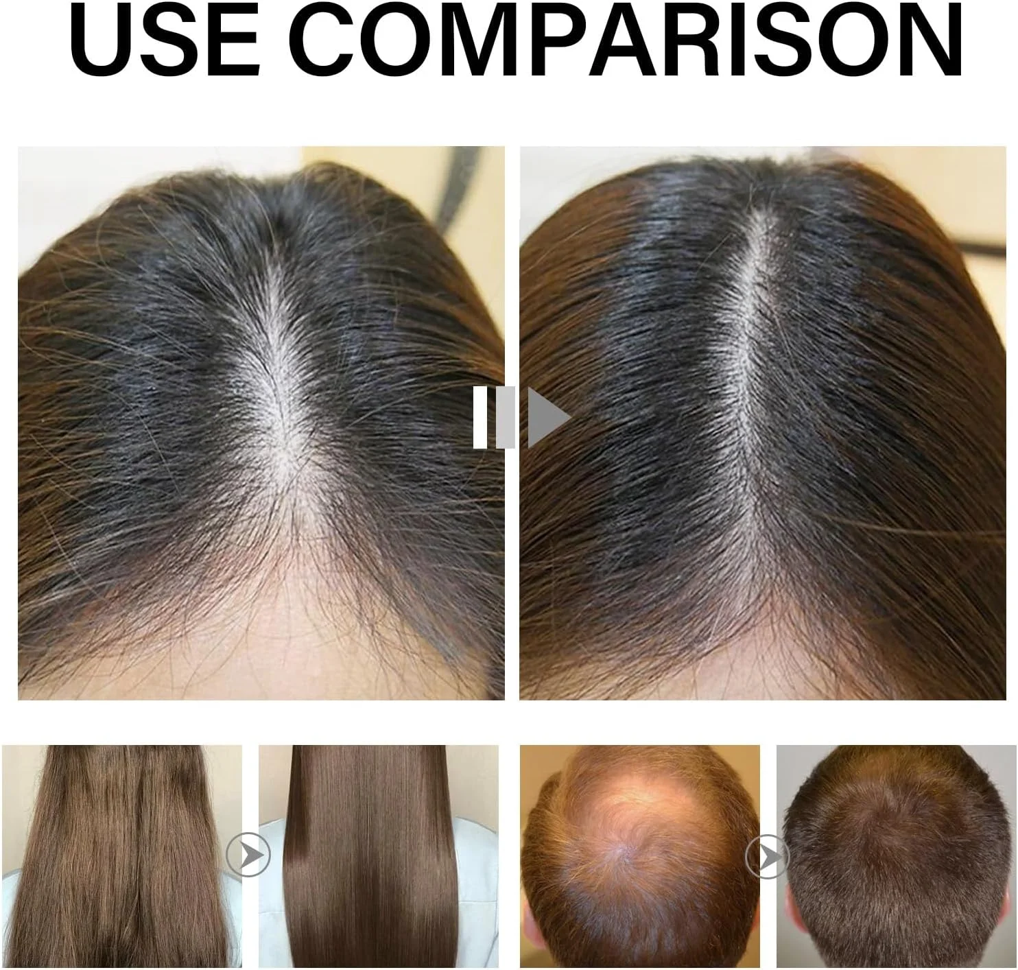 سرم تقویت کننده مو حاوی دئوکسی ریبوز و ژل شکر KUNLEN