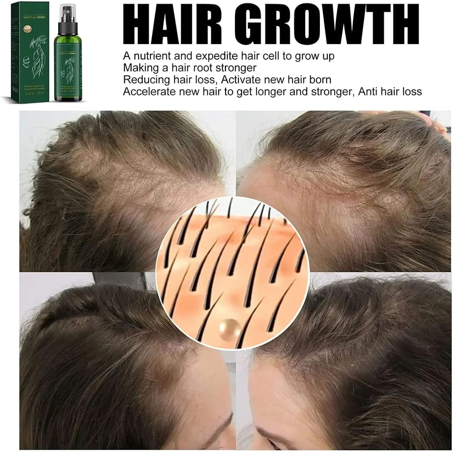 اسپری احیا کننده مو جینسینگ قرمز KORTIN - اسپری سرم رشد مو جینسینگ هیونگانگ کره، سرم اسپری رشد مو زنجبیل، تغذیه کننده پوست سر ضد ریزش مو برای زنان و مردان (2 عدد) اسپری احیا کننده مو جینسینگ قرمز KORTIN - اسپری سرم رشد مو جینسینگ هیونگانگ کره، سرم اسپری رشد مو زنجبیل، تغذیه کننده پوست سر ضد ریزش مو برای زنان و مردان (2 عدد)