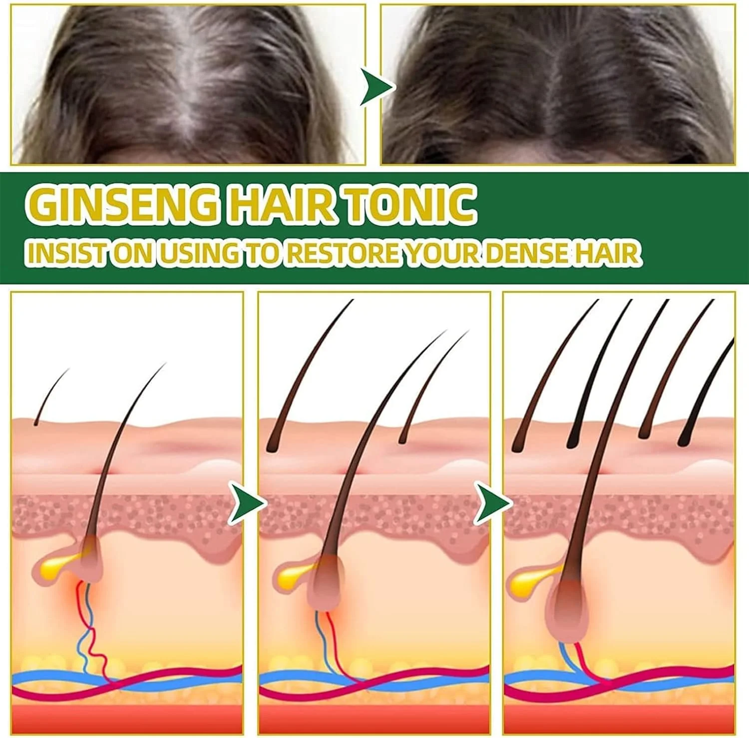 اسپری بازسازی مو با جینسینگ قرمز KORTIN، اسپری سرم رویش مجدد مو با جینسینگ کره ای هیونگانگ برای جلوگیری از ریزش موی زنان و مردان (1 عدد) اسپری بازسازی مو با جینسینگ قرمز KORTIN، اسپری سرم رویش مجدد مو با جینسینگ کره ای هیونگانگ برای جلوگیری از ریزش موی زنان و مردان (1 عدد)