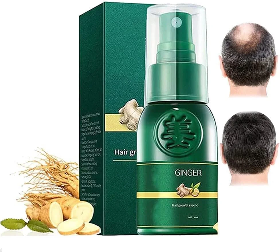 اسپری رشد مو JANGOU Oveallgo Shougagro ژاپنی، اسپری سرم رشد مو زنجبیلی، اسپری سرم احیای مو جینسینگ کره ای Hyungang، اسپری ضخیم کننده مو، سرم زنجبیل جلوگیری از ریزش مو (3 عدد) اسپری رشد مو JANGOU Oveallgo Shougagro ژاپنی، اسپری سرم رشد مو زنجبیلی، اسپری سرم احیای مو جینسینگ کره ای Hyungang، اسپری ضخیم کننده مو، سرم زنجبیل جلوگیری از ریزش مو (3 عدد)