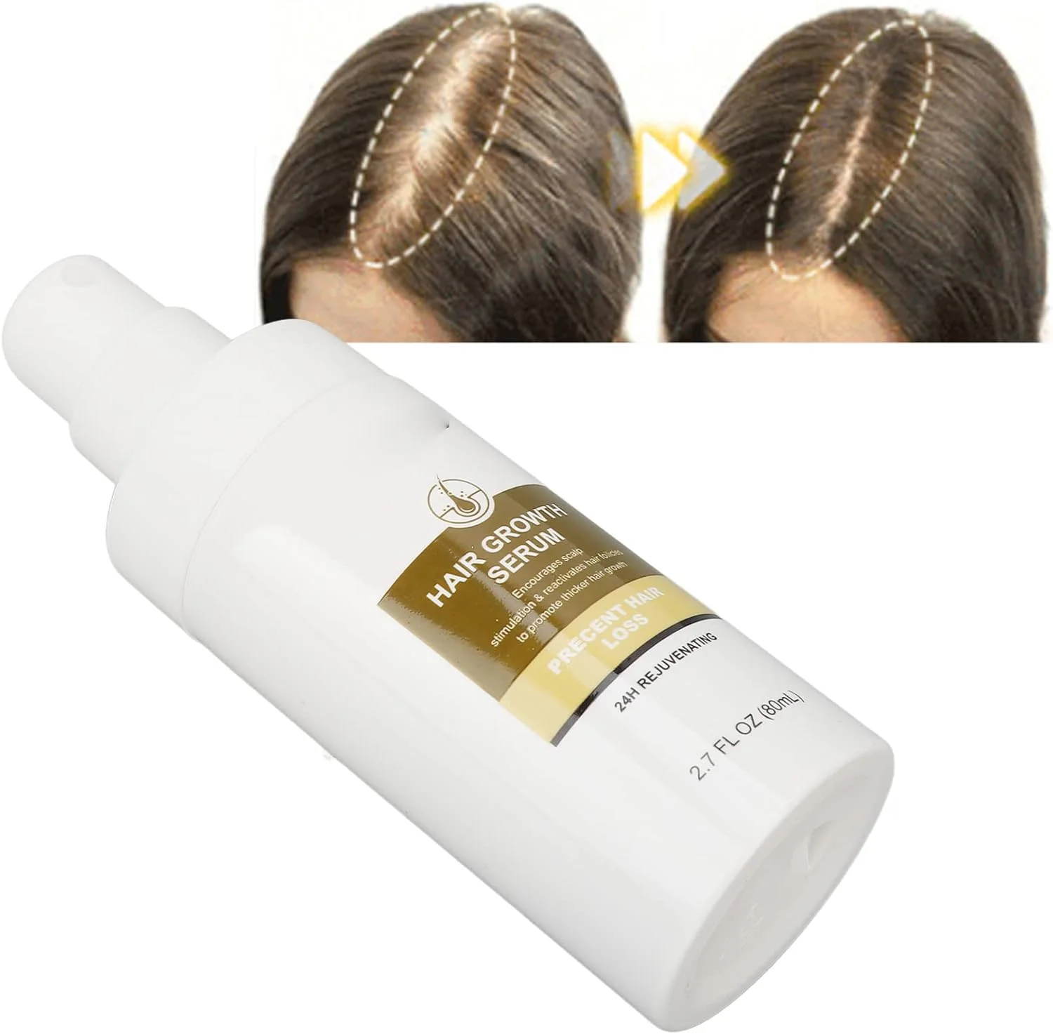 سرم رشد مو زنجبیلی 80 میلی لیتری، مایع مغذی و ضخیم کننده قوی برای موهای بلند، روغن جوانه زنجبیل، درمان کم پشتی و ریزش مو، تقویت رشد ضخیم مو، ضد ریزش مو سرم رشد مو زنجبیلی 80 میلی لیتری، مایع مغذی و ضخیم کننده قوی برای موهای بلند، روغن جوانه زنجبیل، درمان کم پشتی و ریزش مو، تقویت رشد ضخیم مو، ضد ریزش مو