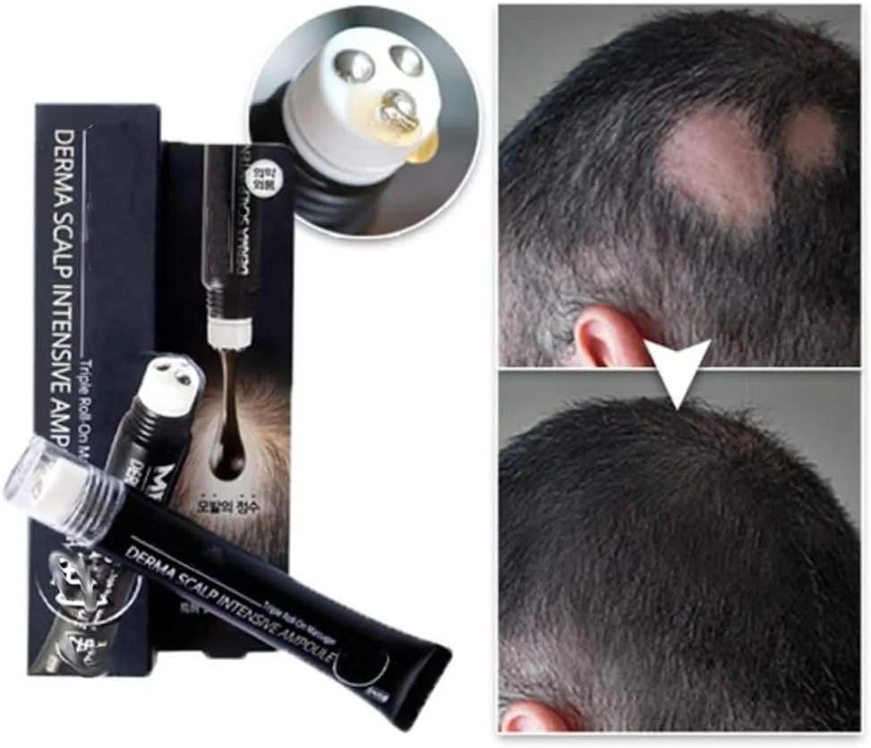 سرم ضد ریزش مو قوی Iwinna، سرم مراقبت از مو با ماساژور پوست سر 20 میلی لیتر، سرم رشد سریع مو رولی برای مردان و زنان سرم ضد ریزش مو قوی Iwinna، سرم مراقبت از مو با ماساژور پوست سر 20 میلی لیتر، سرم رشد سریع مو رولی برای مردان و زنان