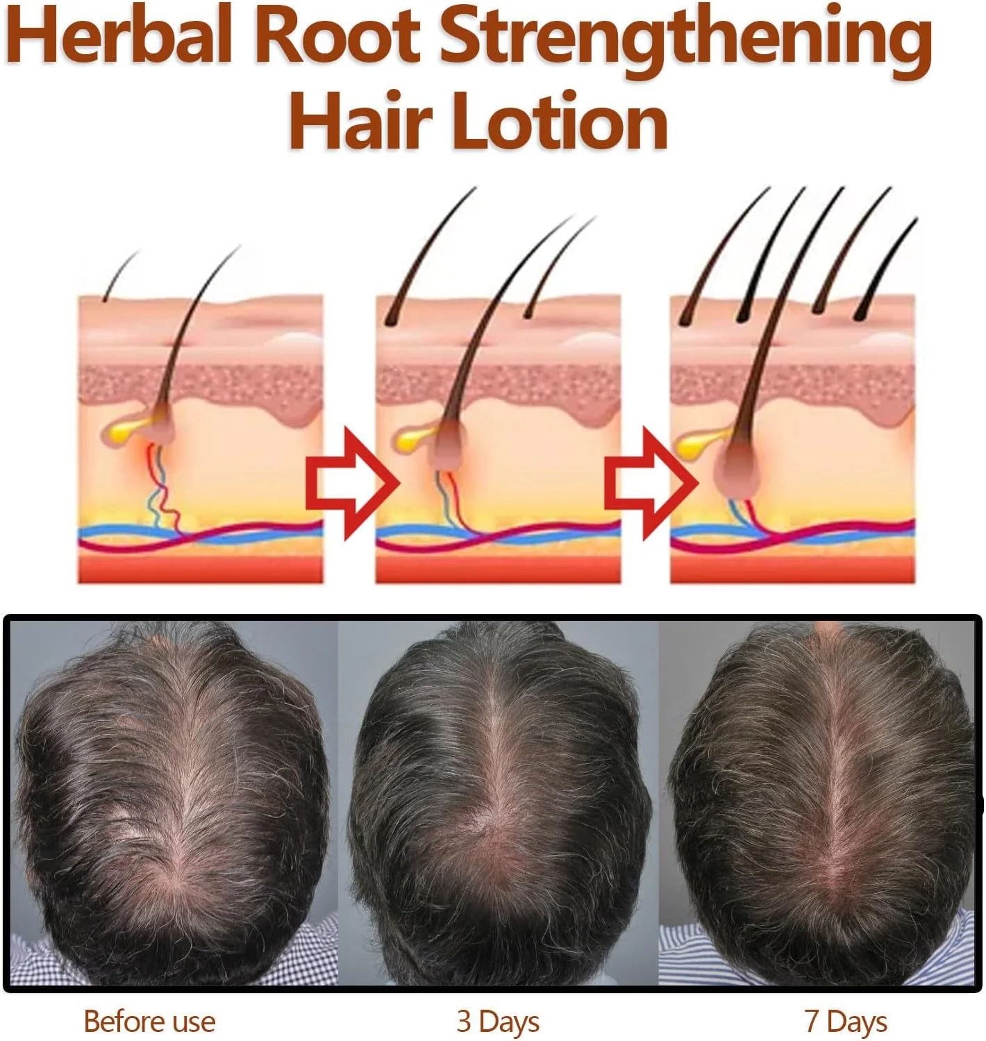 لوسیون گیاهی تقویت کننده ریشه مو، سرم رشد مو لوسیون مو برای آقایان و خانم ها، لوسیون مو ریشه مو ریش، اسپری درمان طبیعی گیاهی لوسیون مو (3 عدد) لوسیون گیاهی تقویت کننده ریشه مو، سرم رشد مو لوسیون مو برای آقایان و خانم ها، لوسیون مو ریشه مو ریش، اسپری درمان طبیعی گیاهی لوسیون مو (3 عدد)