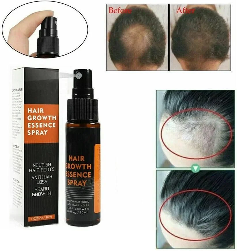 اسپری سرم اسانس گیاهی رشد مو، ضد ریزش مو، رشد سریع، جلوگیری از خشکی مو (1 عدد) اسپری سرم اسانس گیاهی رشد مو، ضد ریزش مو، رشد سریع، جلوگیری از خشکی مو (1 عدد)