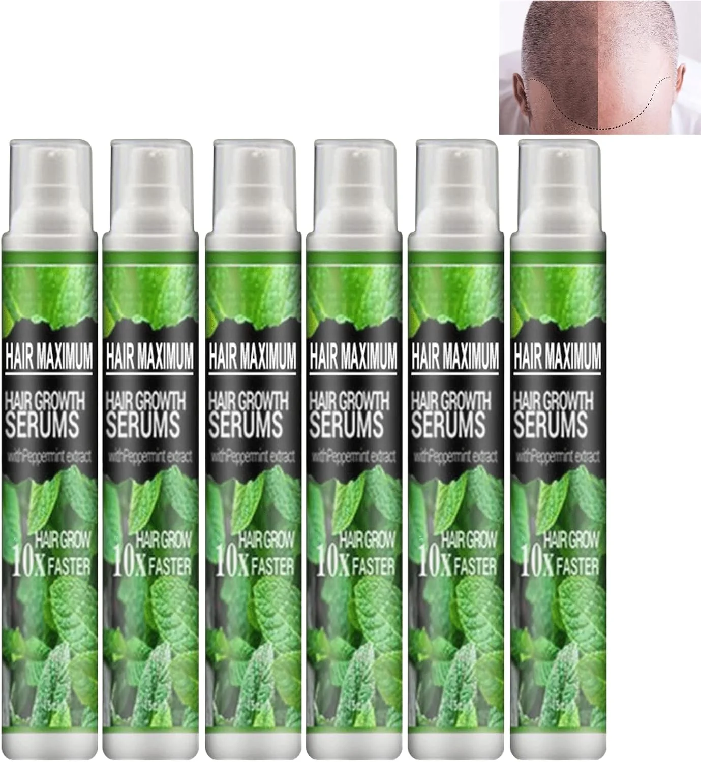 اسپری اسانس گیاهی رشد مو، اسپری گیاهی احیای مو، اسپری سرم ضد ریزش مو، درمان های سریع رشد ضد ریزش مو، روغن رشد مو برای ریزش مو (6 عدد) اسپری اسانس گیاهی رشد مو، اسپری گیاهی احیای مو، اسپری سرم ضد ریزش مو، درمان های سریع رشد ضد ریزش مو، روغن رشد مو برای ریزش مو (6 عدد)