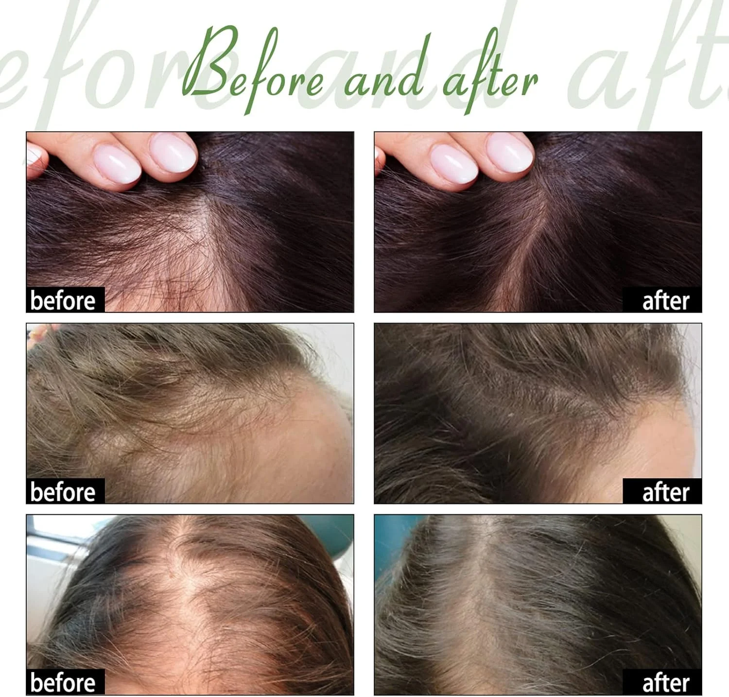 سرم مایع گیاهی روغن ضروری برای رشد مو، تقویت ریشه، ترمیم موهای آسیب دیده، 20 میلی لیتر، تغذیه کننده پوست سر برای مراقبت روزانه