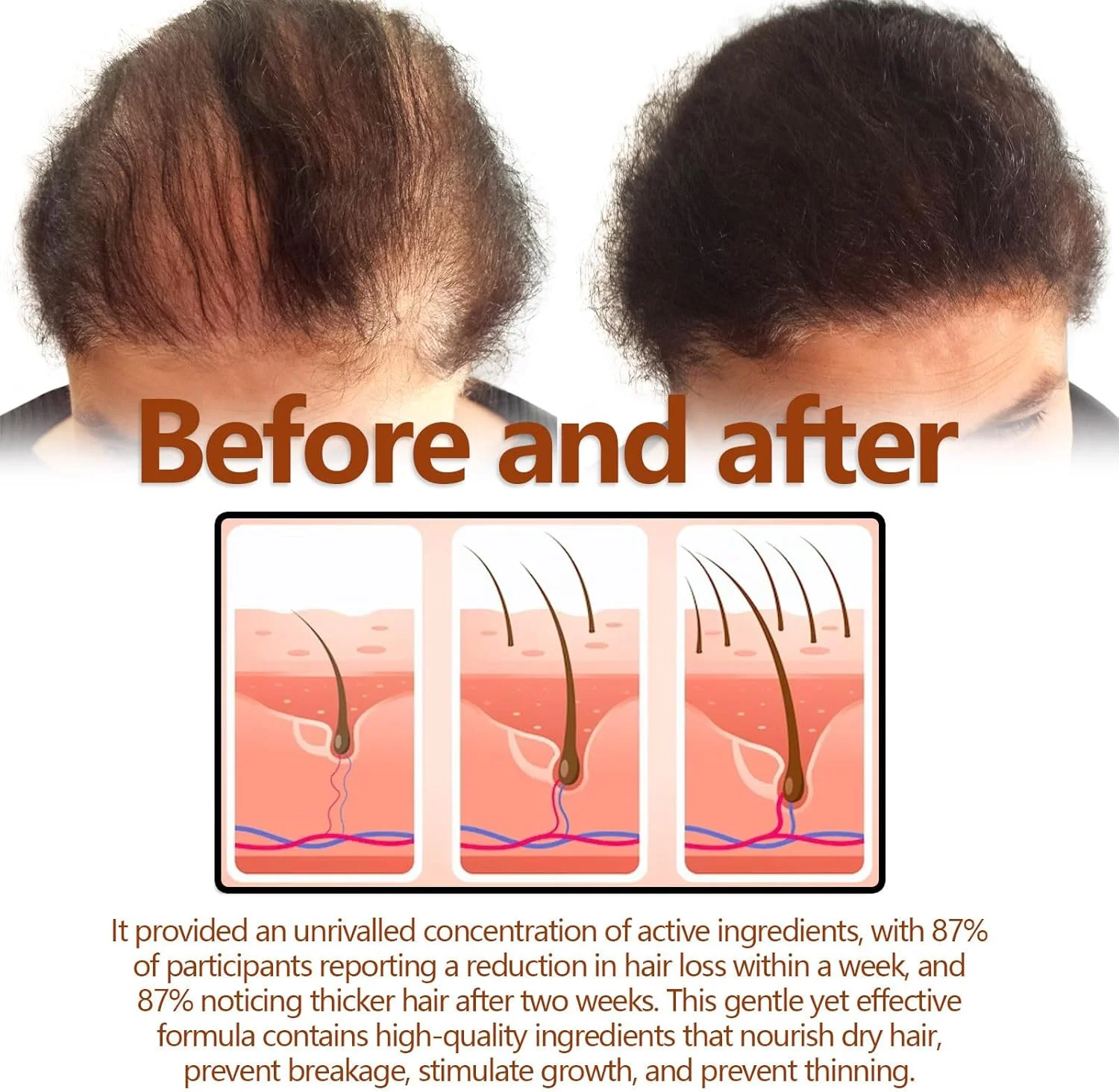 لوسیون گیاهی تقویت کننده ریشه مو، سرم رشد مو لوسیون مو برای آقایان و خانم ها، لوسیون مو ریشه مو ریش، اسپری درمان طبیعی گیاهی لوسیون مو (3 عدد) لوسیون گیاهی تقویت کننده ریشه مو، سرم رشد مو لوسیون مو برای آقایان و خانم ها، لوسیون مو ریشه مو ریش، اسپری درمان طبیعی گیاهی لوسیون مو (3 عدد)