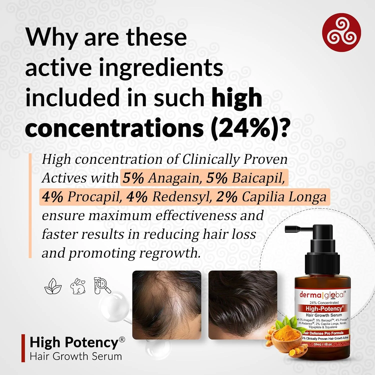 سرم تقویت کننده مو High Potency® - فرمول حرفه ای محافظت از مو | 24% مواد فعال اثبات شده بالینی با 5% آناگین، 5% بایکاپیل، 4% پروکاپیل، رِدِنسِیل، 2% کاپیلیا لونگا، نیاسینامید و پپتید مس 30 میلی لیتر