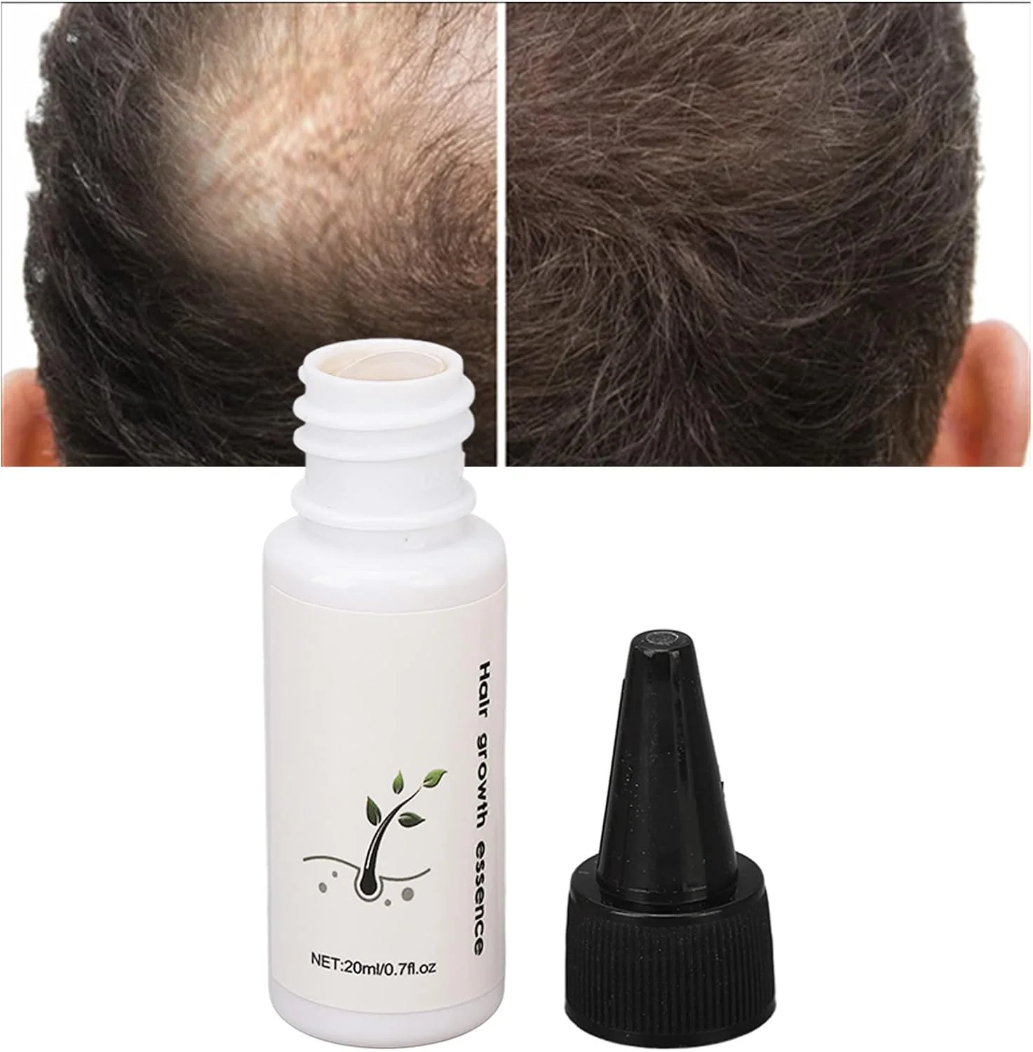 سرم مایع گیاهی روغن ضروری برای رشد مو، تقویت ریشه، ترمیم موهای آسیب دیده، 20 میلی لیتر، تغذیه کننده پوست سر برای مراقبت روزانه