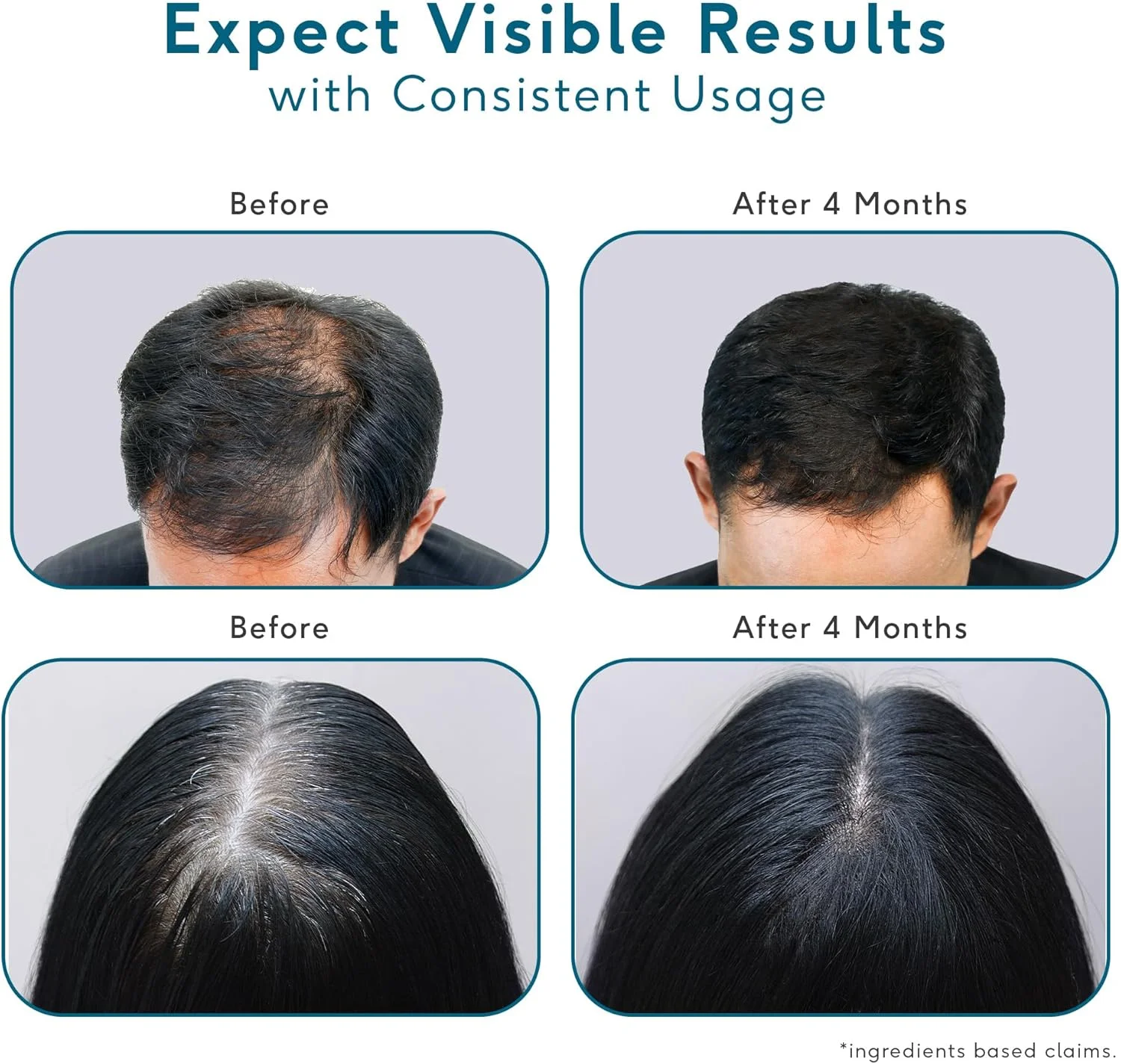 سرم رشد مو هِلت کارت اچ کی ویتالز حاوی 3% Redensyl، 2% Anagain و 2% Cressatine، برای رشد و تقویت مو، تست شده توسط متخصصین پوست، 30 میلی لیتر، 30 گرم