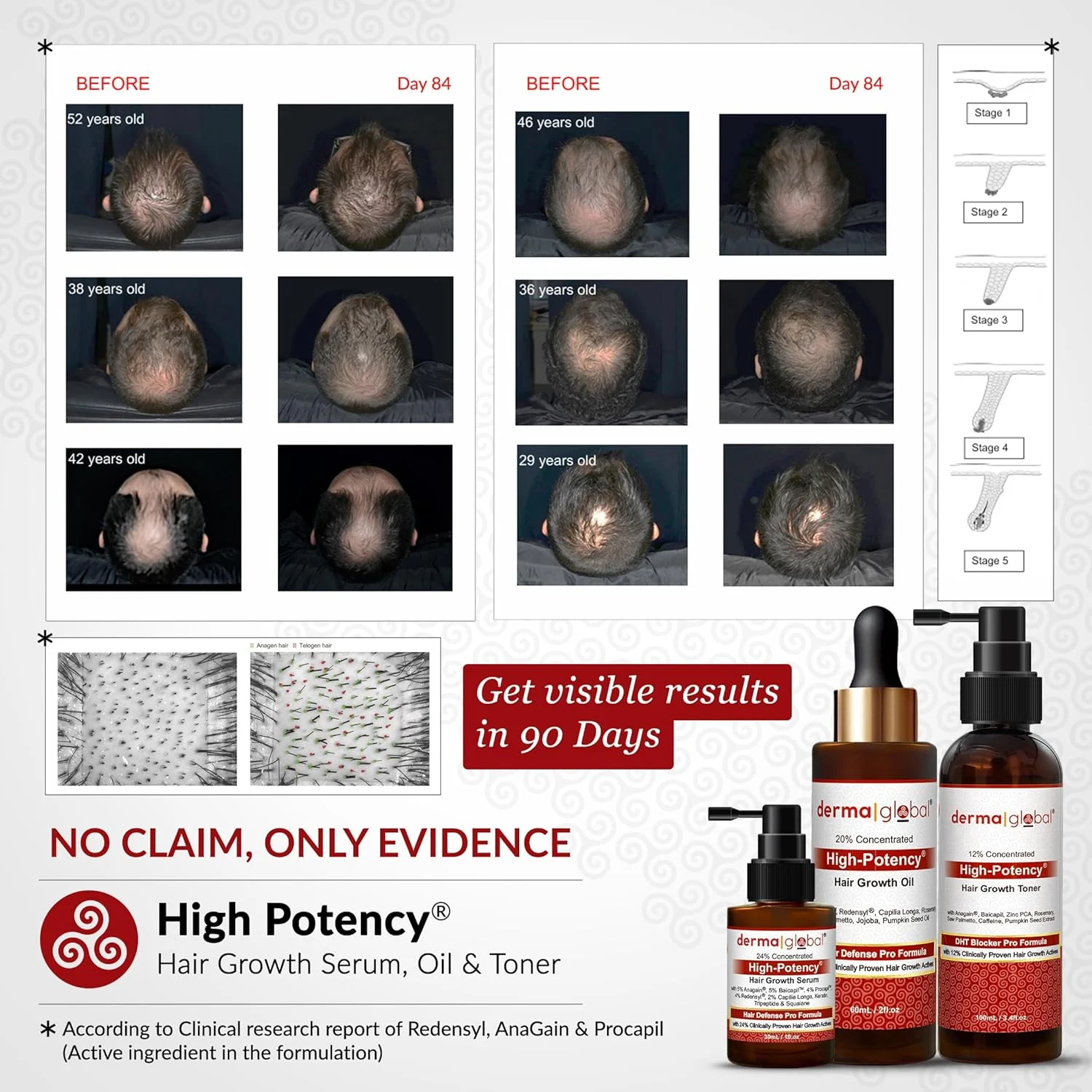 سرم تقویت کننده مو High Potency® - فرمول حرفه ای محافظت از مو | 24% مواد فعال اثبات شده بالینی با 5% آناگین، 5% بایکاپیل، 4% پروکاپیل، رِدِنسِیل، 2% کاپیلیا لونگا، نیاسینامید و پپتید مس 30 میلی لیتر