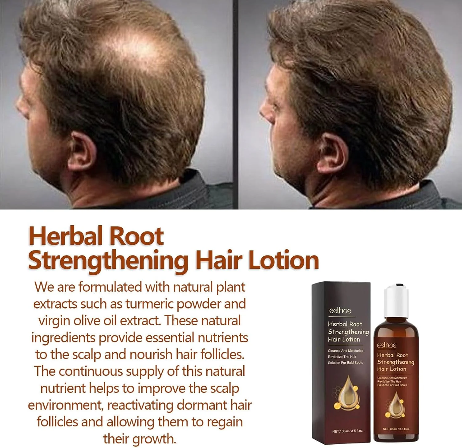 لوسیون گیاهی تقویت کننده ریشه مو، سرم رشد مو لوسیون مو برای آقایان و خانم ها، لوسیون مو ریشه مو ریش، اسپری درمان طبیعی گیاهی لوسیون مو (3 عدد) لوسیون گیاهی تقویت کننده ریشه مو، سرم رشد مو لوسیون مو برای آقایان و خانم ها، لوسیون مو ریشه مو ریش، اسپری درمان طبیعی گیاهی لوسیون مو (3 عدد)