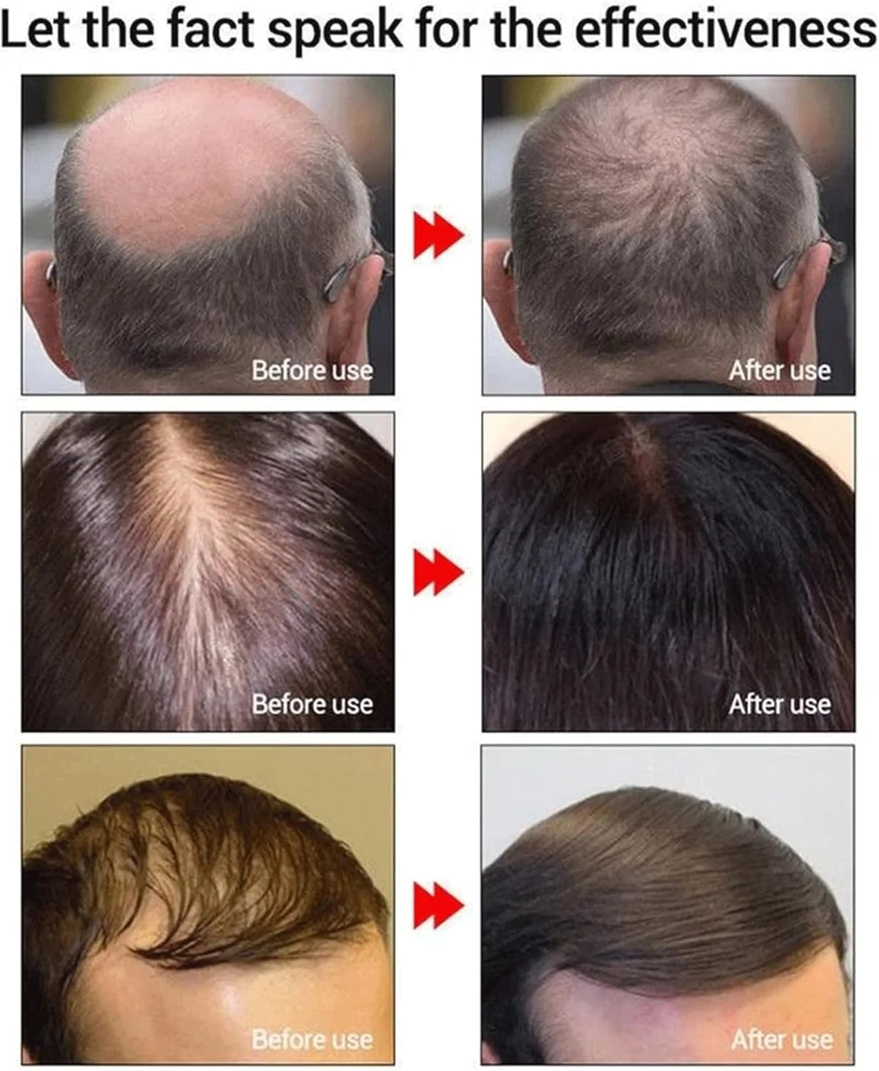 اسپری اسانس گیاهی رشد مو، اسپری گیاهی احیای مو، اسپری سرم ضد ریزش مو، درمان های سریع رشد ضد ریزش مو، روغن رشد مو برای ریزش مو (6 عدد) اسپری اسانس گیاهی رشد مو، اسپری گیاهی احیای مو، اسپری سرم ضد ریزش مو، درمان های سریع رشد ضد ریزش مو، روغن رشد مو برای ریزش مو (6 عدد)