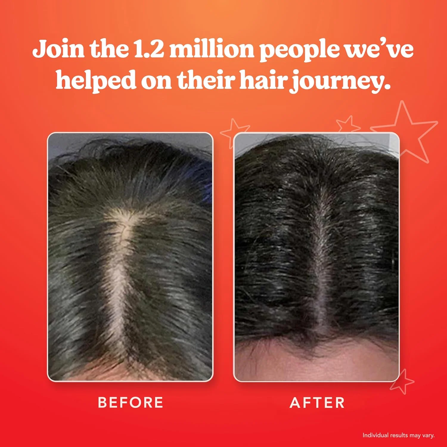 سرم پوست سر هیرتامین، درمان طبیعی برای رشد و ضخیم شدن مو | به طور مشهود موهایی ضخیم تر را افزایش می دهد و سلامت پوست سر را ارتقا می بخشد | تغذیه و آبرسانی پوست سر خشک و خارش دار