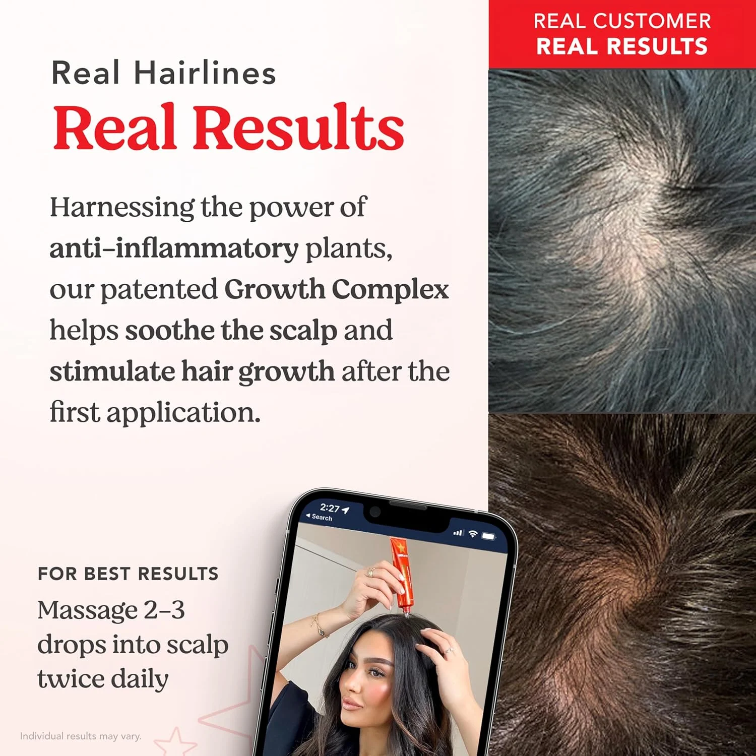 سرم پوست سر هیرتامین، درمان طبیعی مو | به طور محسوسی باعث افزایش ضخامت مو می شود و سلامت پوست سر را ارتقا می دهد | تغذیه و آبرسانی پوست سر خشک و خارش دار (دو عددی) سرم پوست سر هیرتامین، درمان طبیعی مو | به طور محسوسی باعث افزایش ضخامت مو می شود و سلامت پوست سر را ارتقا می دهد | تغذیه و آبرسانی پوست سر خشک و خارش دار (دو عددی)