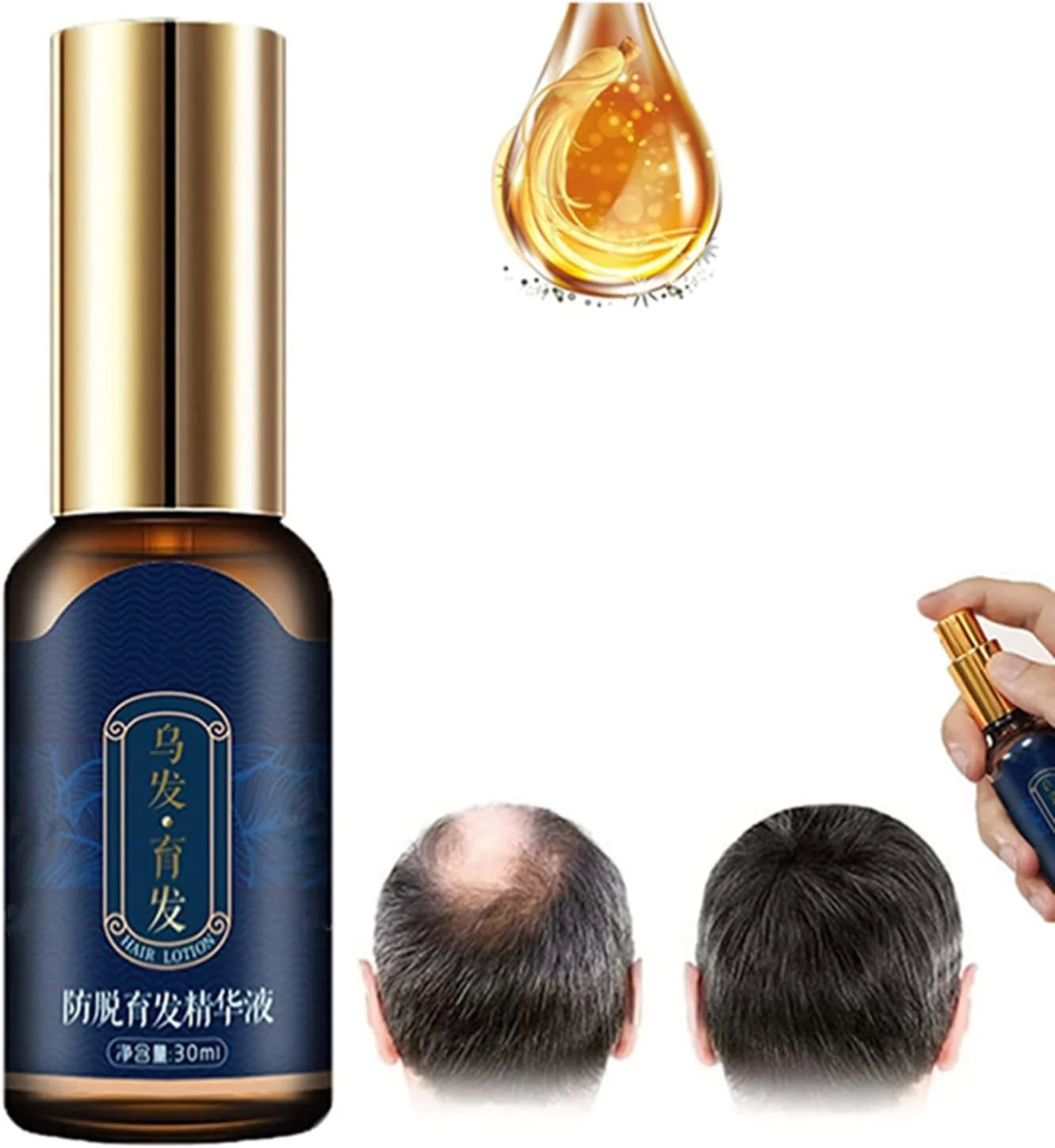 اسپری تقویت کننده مو ZOKU-HGP، اسپری محرک مو، سرم رشد مو Polygonum Multiflorum، روغن های ضروری زنجبیل برای رشد مو برای مردان و زنان 30 میلی لیتر (1 عدد) اسپری تقویت کننده مو ZOKU-HGP، اسپری محرک مو، سرم رشد مو Polygonum Multiflorum، روغن های ضروری زنجبیل برای رشد مو برای مردان و زنان 30 میلی لیتر (1 عدد)