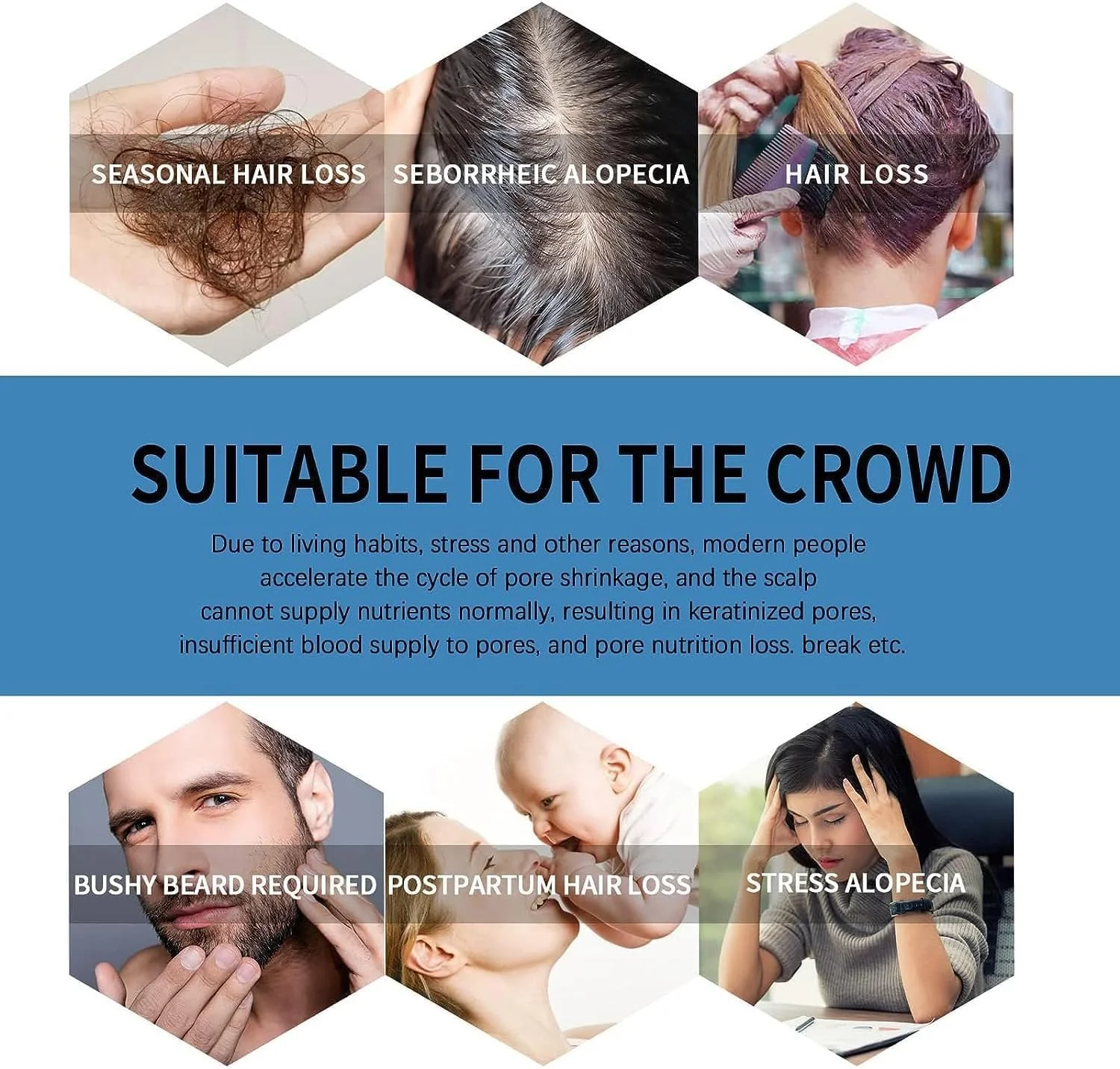 محلول رولی Hair Growth X، سرم رشد مو Hairgrowth-X برای آقایان و بانوان، Hairgrowth-X - روغن ضروری غلیظ کننده مو و ریش، 10 برابر برای تقویت رشد مو (3 عدد)