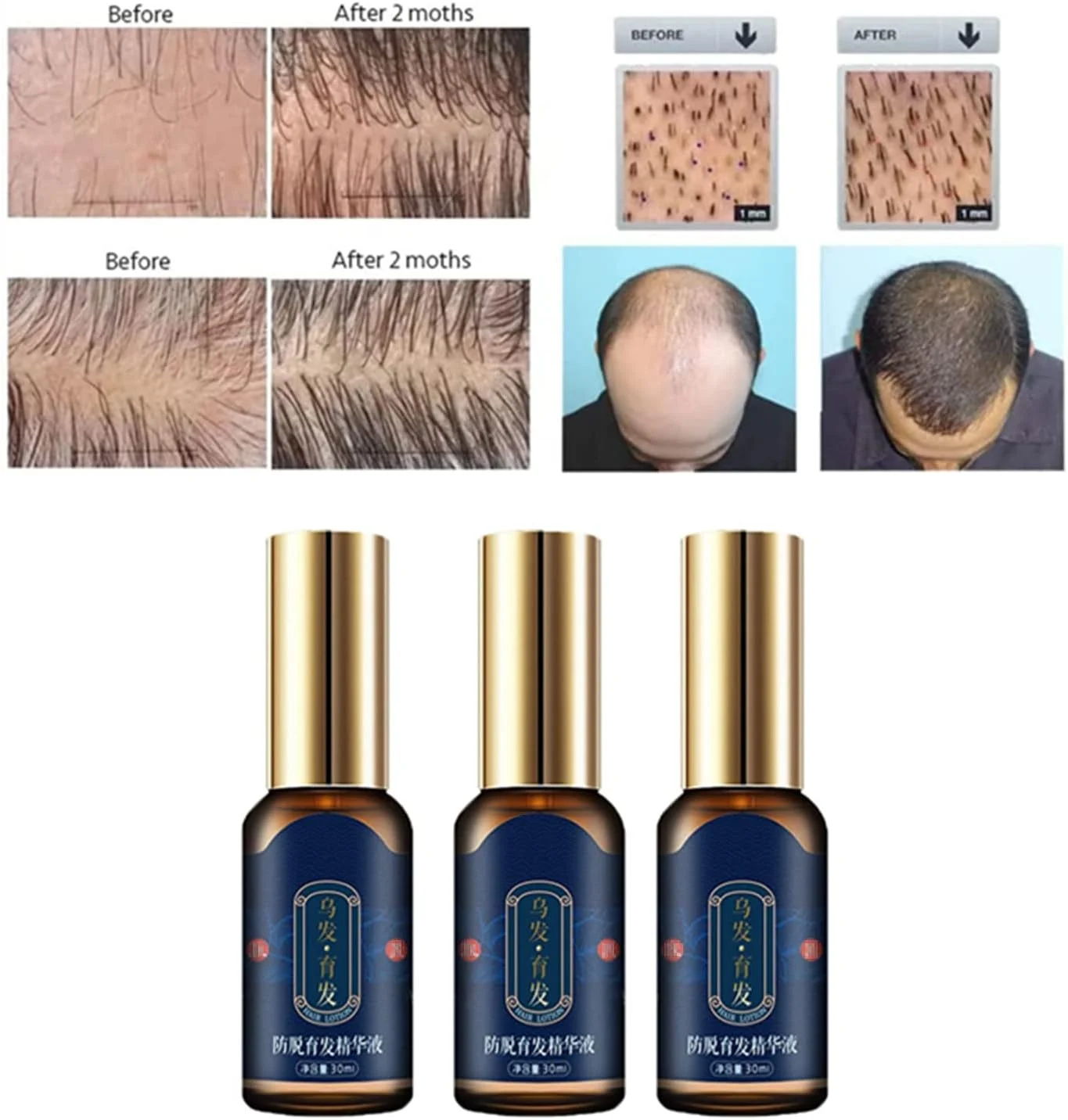 اسپری تقویت کننده مو ZOKU-HGP، اسپری محرک مو، سرم رشد مو Polygonum Multiflorum، روغن های ضروری زنجبیل برای رشد مو برای مردان و زنان 30 میلی لیتر (1 عدد)