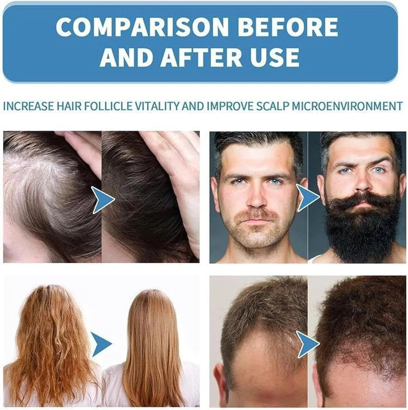 محلول رولی Hair Growth X، سرم رشد مو Hairgrowth-X برای آقایان و بانوان، Hairgrowth-X - روغن ضروری غلیظ کننده مو و ریش، 10 برابر برای تقویت رشد مو (3 عدد)