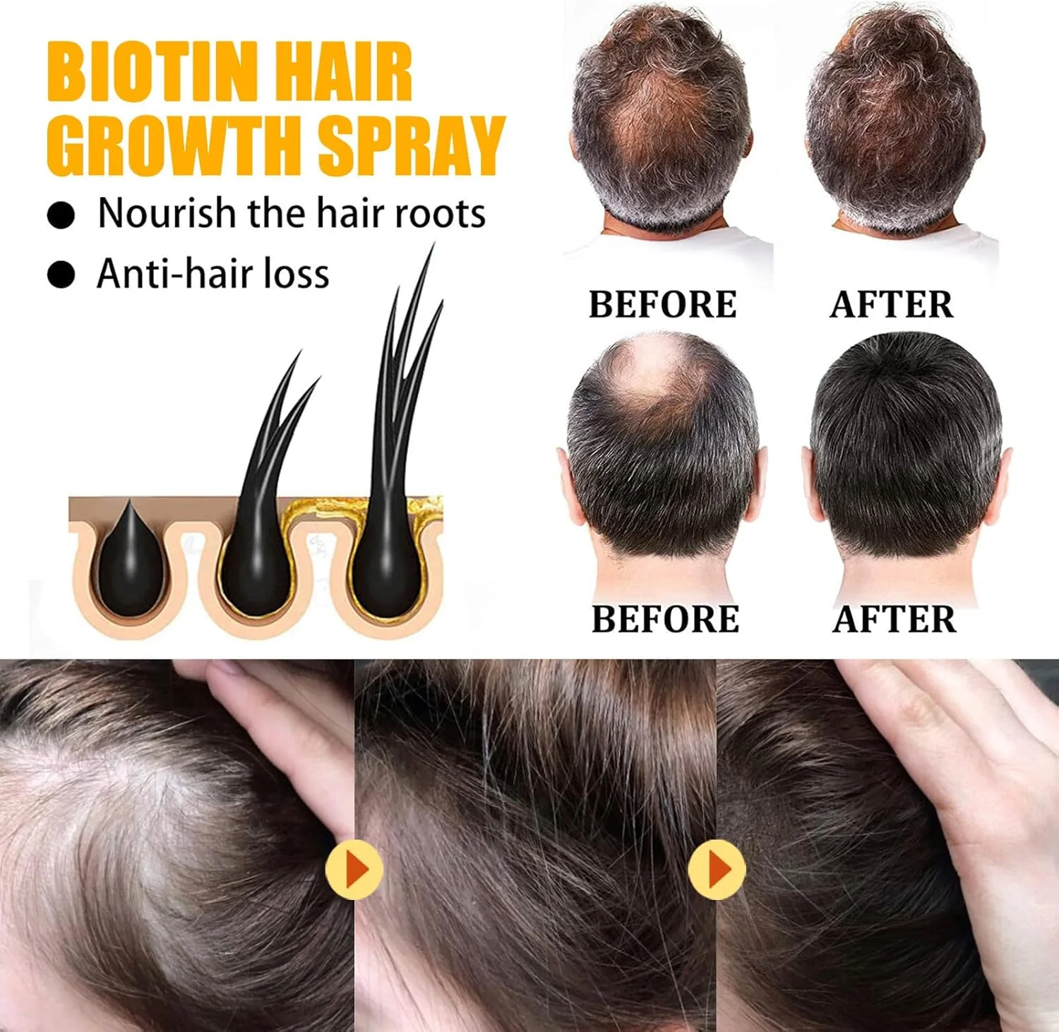 سرم رشد مو HairTkekruh بیوتین 30 میلی لیتر، اسپری مو بیوتین، اسپری رشد مو بیوتین، اسپری تسریع رشد مو، جلوگیری از ریزش مو، برای موهای نازک، شکننده و خشک سرم رشد مو HairTkekruh بیوتین 30 میلی لیتر، اسپری مو بیوتین، اسپری رشد مو بیوتین، اسپری تسریع رشد مو، جلوگیری از ریزش مو، برای موهای نازک، شکننده و خشک