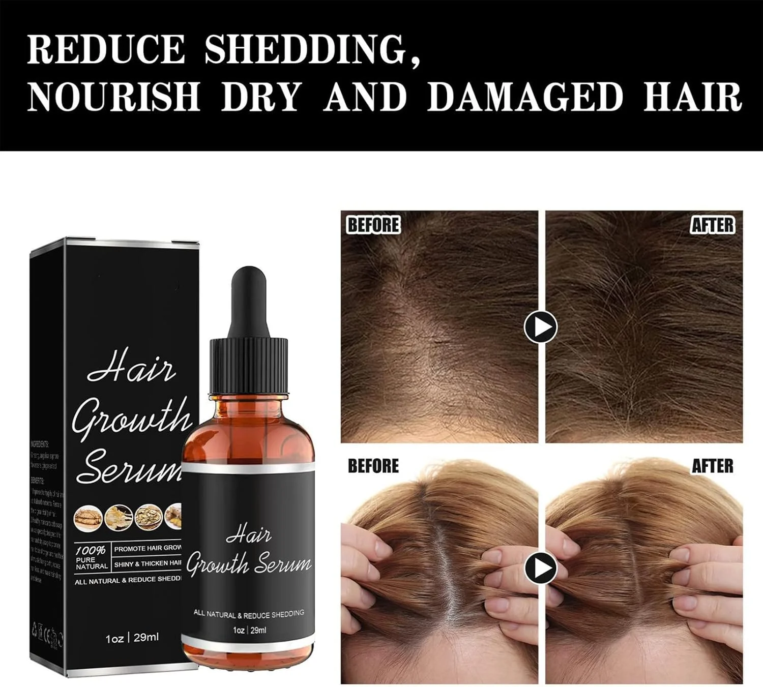 سرم ویتامین رشد مو، سرم برای ریزش مو و رشد مجدد مو - روغن زنجبیل برای رشد موهای نازک - مرطوب کننده و ترمیم کننده مراقبت از موهای خشک و آسیب دیده - درمان رشد مجدد مو برای مردان و زنان سرم ویتامین رشد مو، سرم برای ریزش مو و رشد مجدد مو - روغن زنجبیل برای رشد موهای نازک - مرطوب کننده و ترمیم کننده مراقبت از موهای خشک و آسیب دیده - درمان رشد مجدد مو برای مردان و زنان