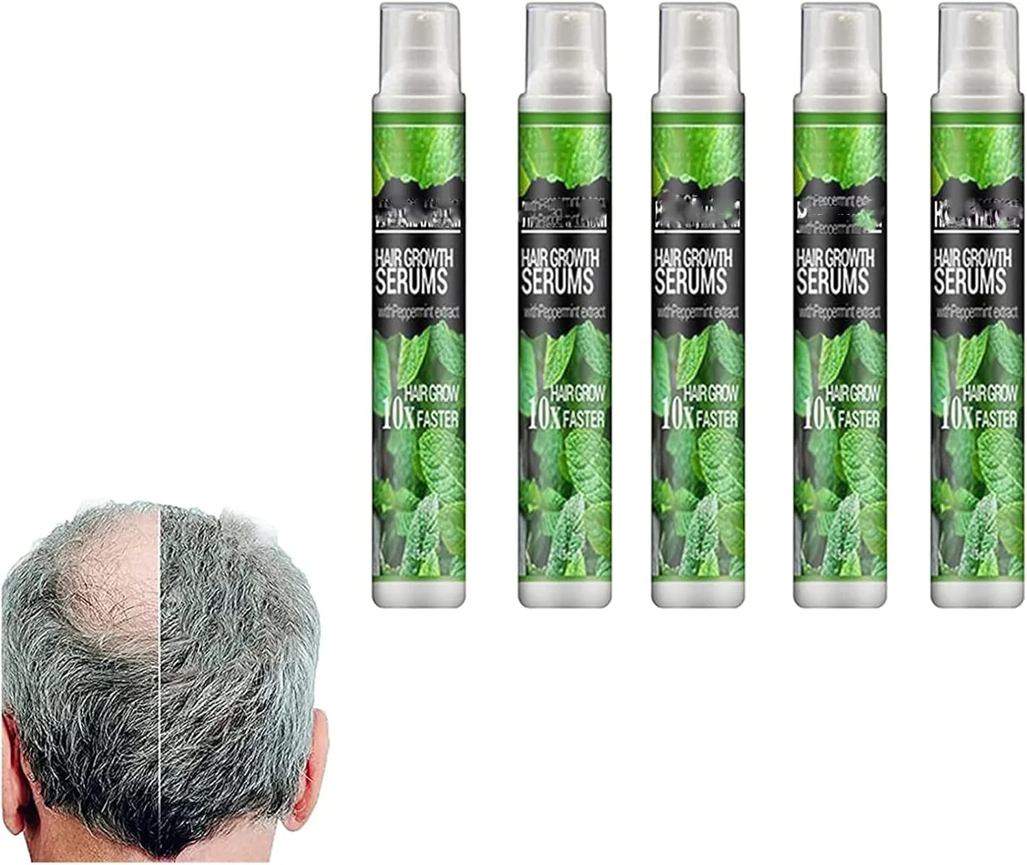 اسپری اسانس گیاهی رشد مو، جلوگیری از ریزش مو بعد از زایمان، اسپری اسانس گیاهی خط رویش مو، اسپری سرم رشد مو، روغن مو برای موهای قوی تر، ضخیم تر و رشد مو برای درمان ریزش مو (5 عدد)