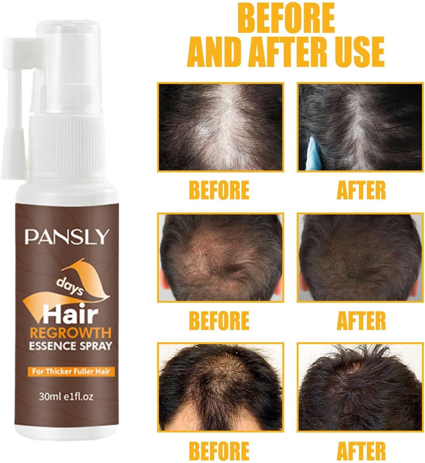 اسپری سرم رشد مو - اسپری ضخیم کننده مو برای موهای نازک - اسپری حداکثر کننده رشد مو، درمان های ریزش مو برای زنان و مردان اسپری سرم رشد مو - اسپری ضخیم کننده مو برای موهای نازک - اسپری حداکثر کننده رشد مو، درمان های ریزش مو برای زنان و مردان