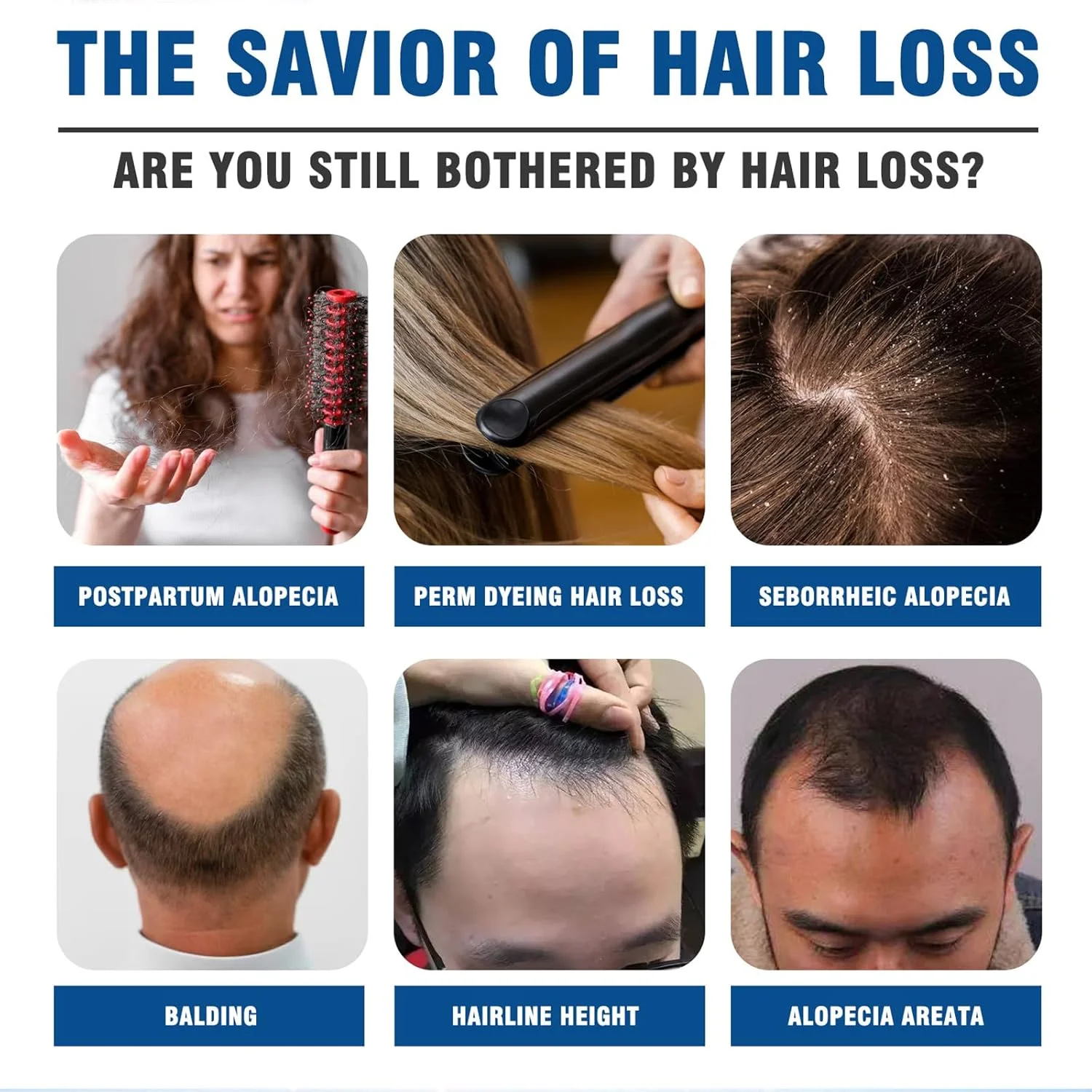 سرم رشد مو - سرم روغنی تقویت کننده و مغذی طبیعی پوست سر برای زنان و مردان - روغن رشد مو رولی - نرم کننده، مغذی و تقویت کننده مو سرم رشد مو - سرم روغنی تقویت کننده و مغذی طبیعی پوست سر برای زنان و مردان - روغن رشد مو رولی - نرم کننده، مغذی و تقویت کننده مو